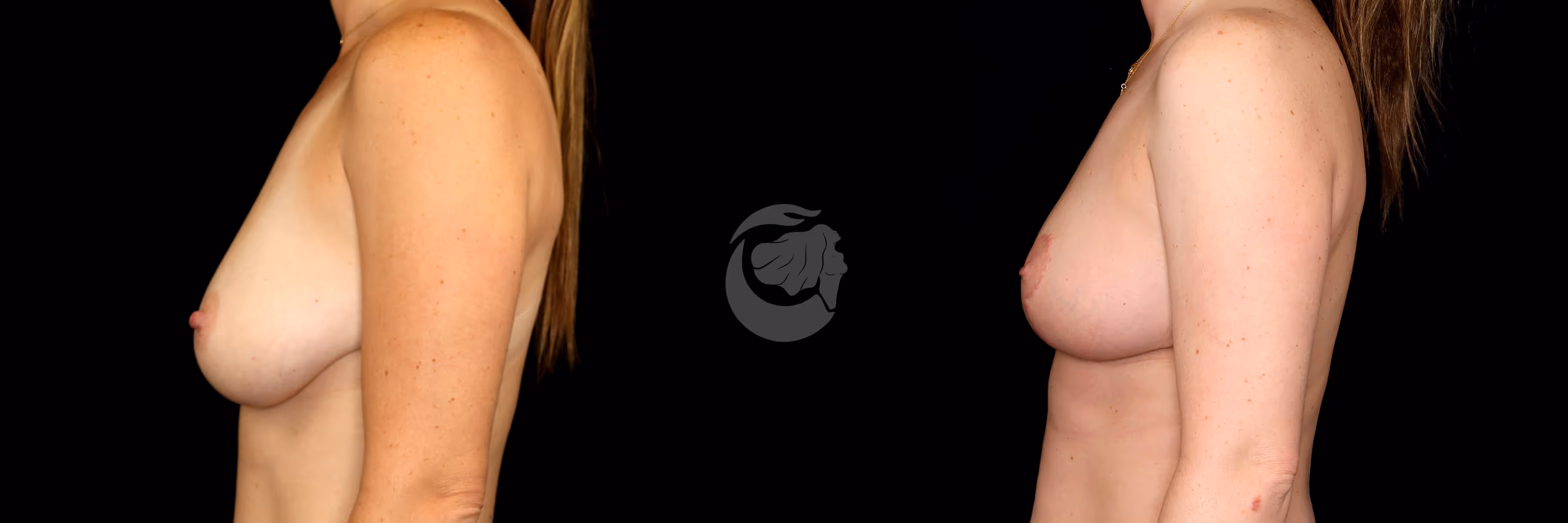 Before And After Patient Image