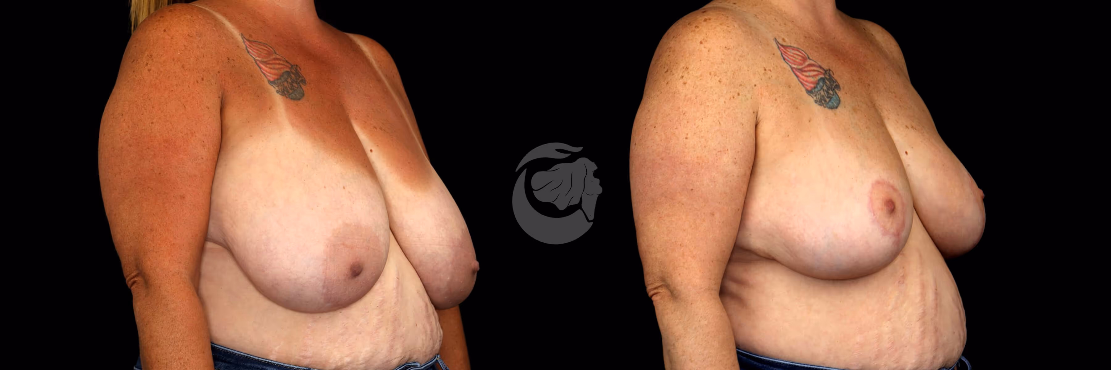 Before And After Patient Image