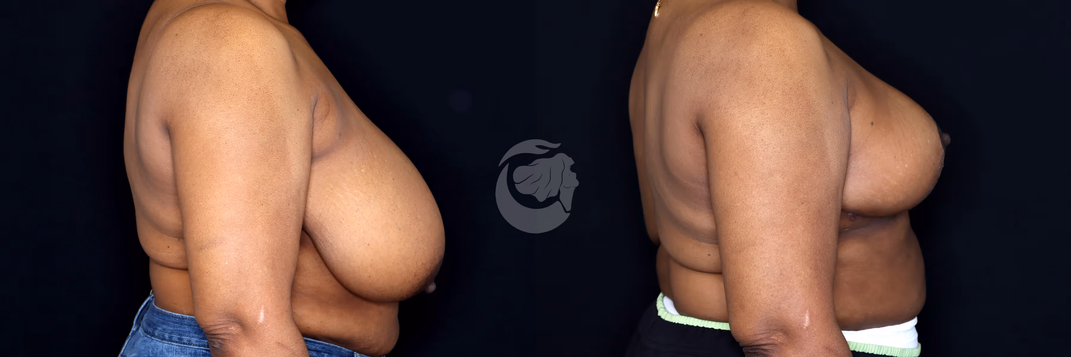 Before And After Patient Image