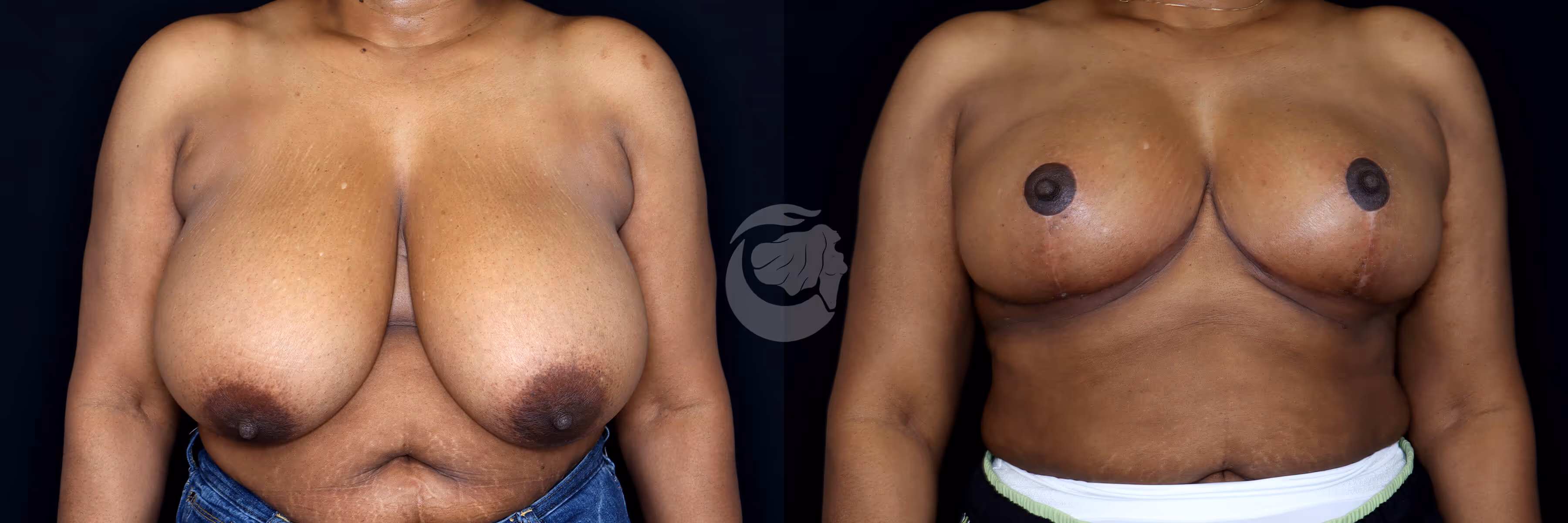 Before And After Patient Image