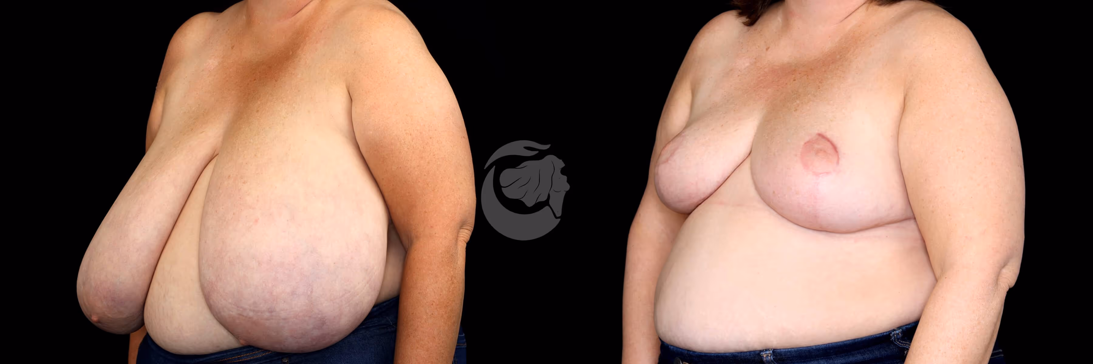 Before And After Patient Image