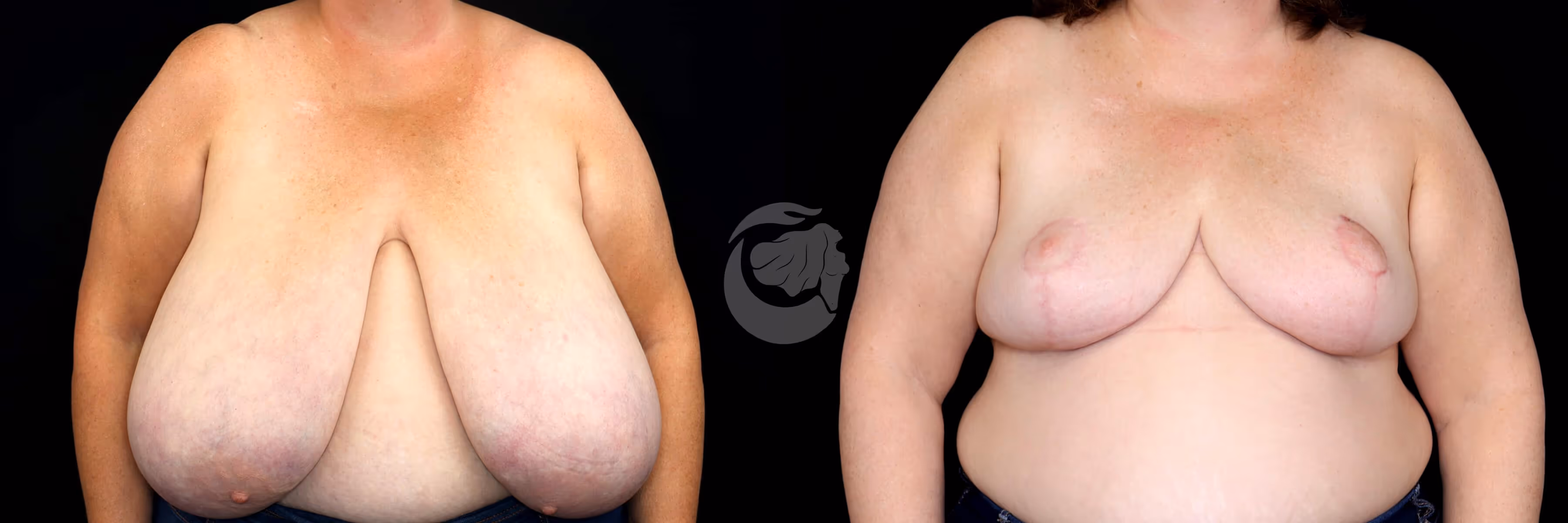 Before And After Patient Image
