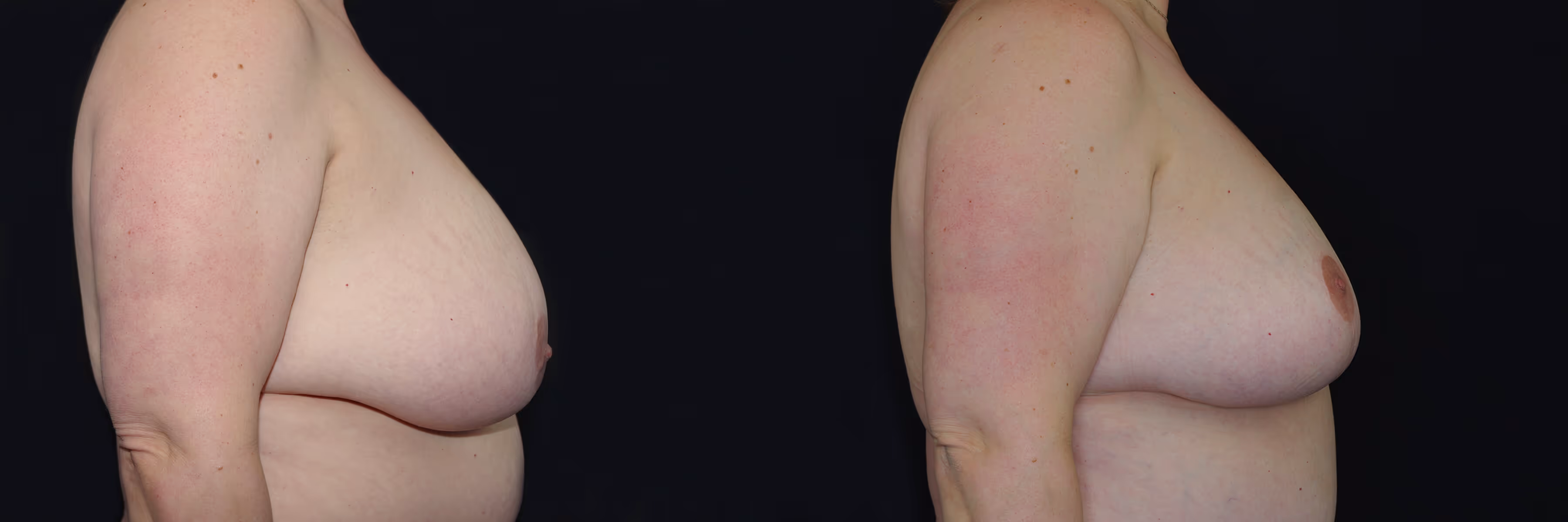 Before And After Patient Image