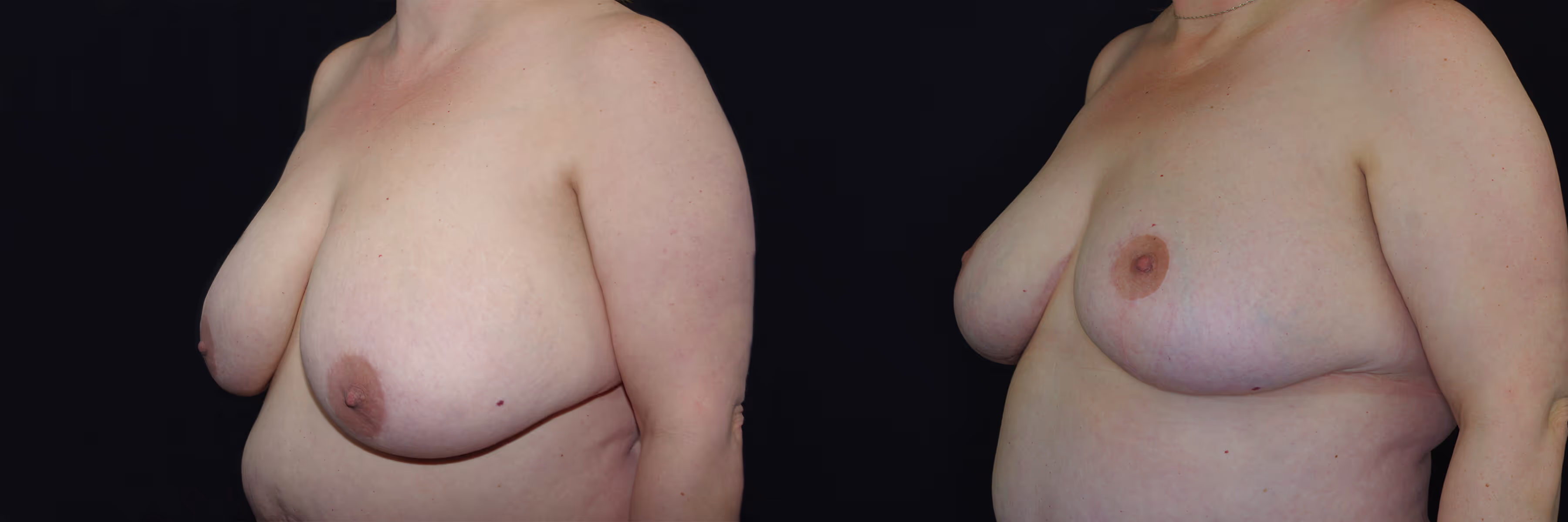 Before And After Patient Image