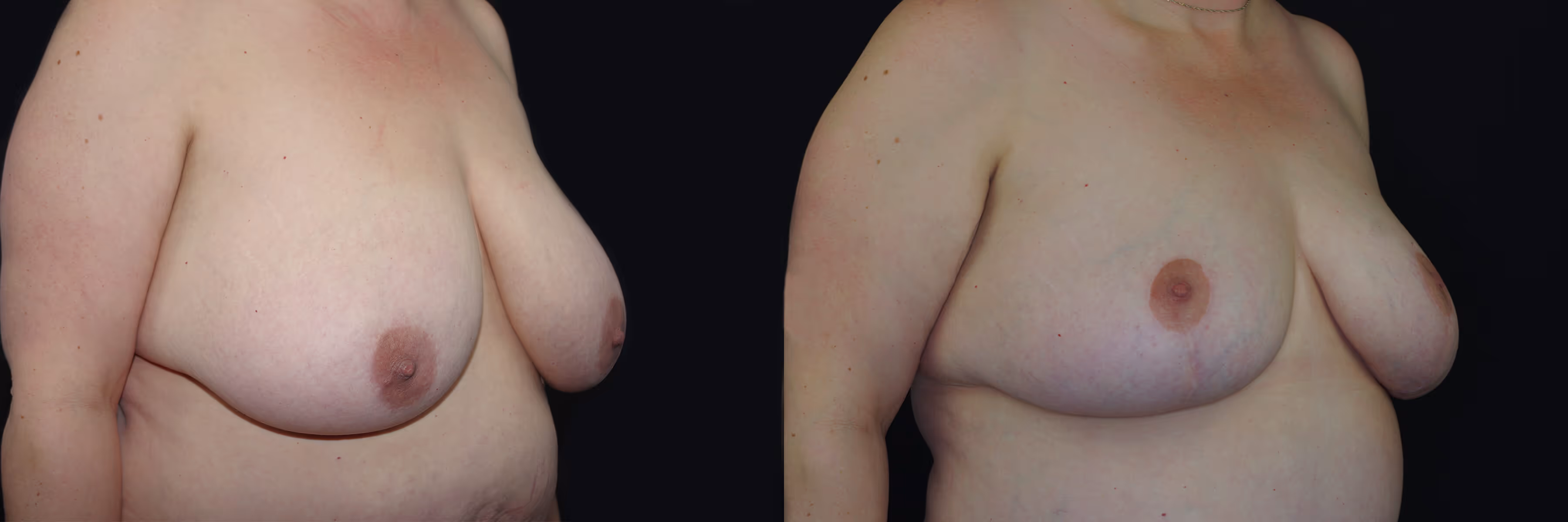 Before And After Patient Image