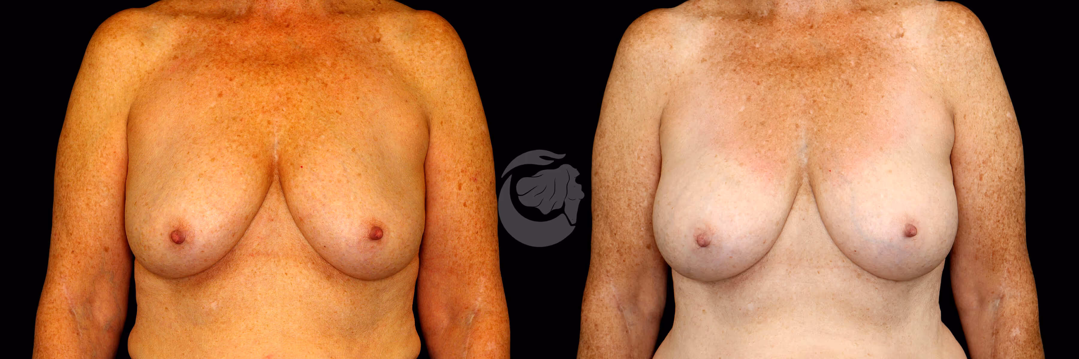 Before And After Patient Image