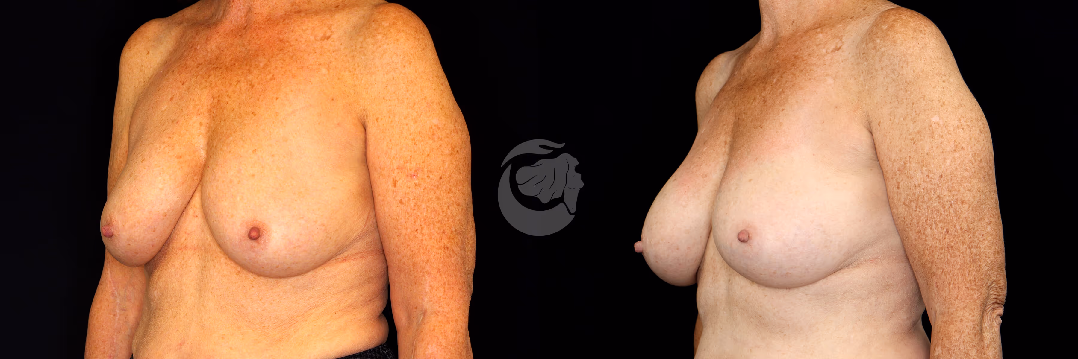 Before And After Patient Image