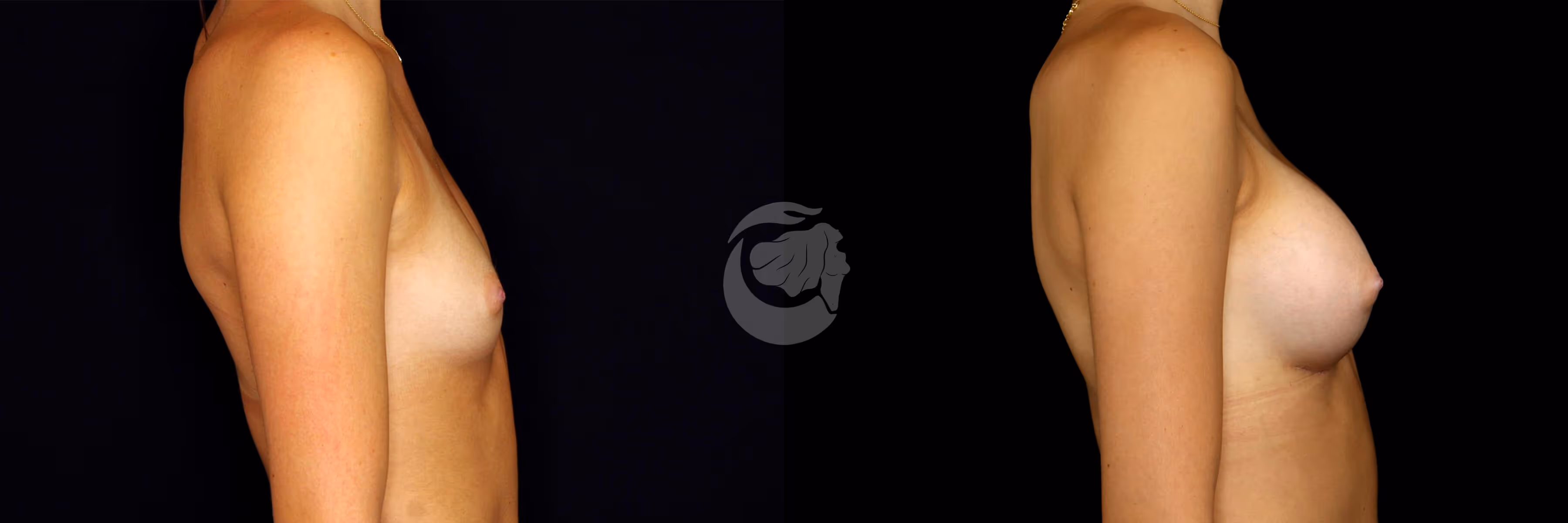 Before And After Patient Image