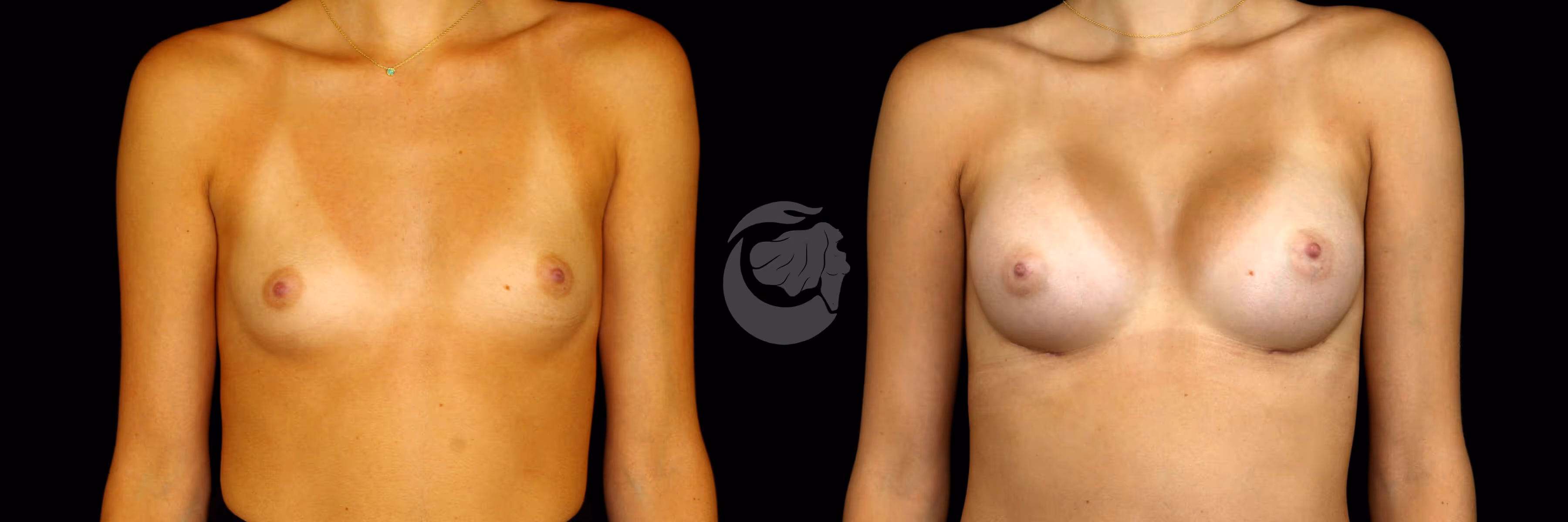 Before And After Patient Image