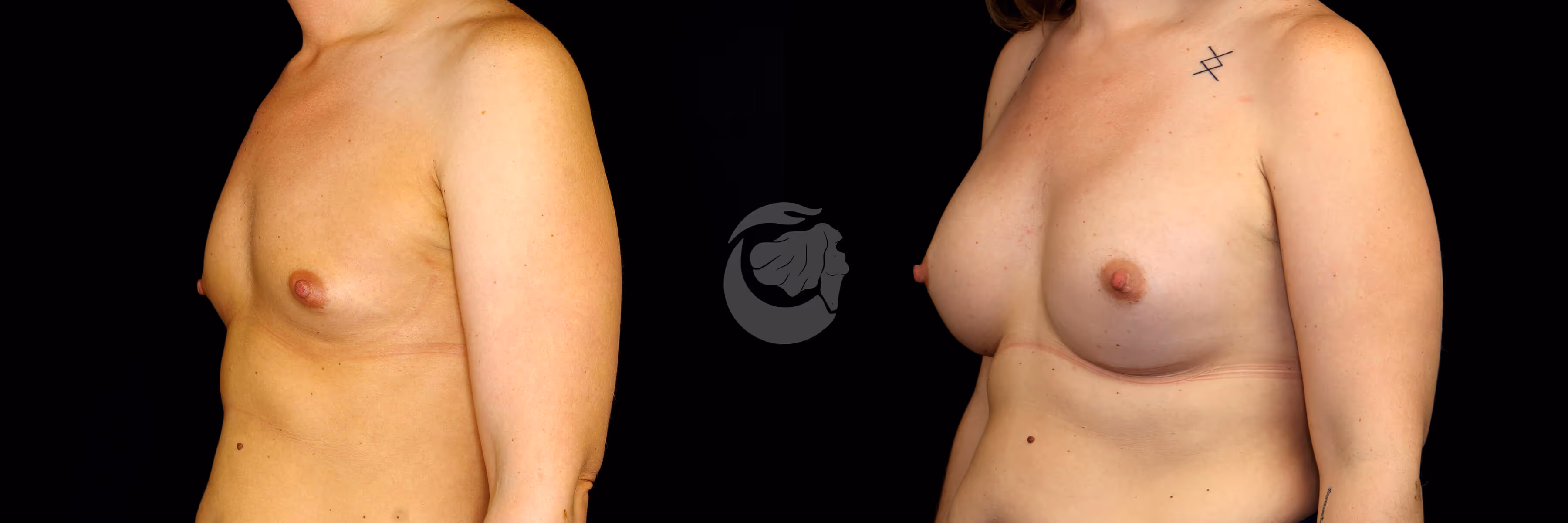Before And After Patient Image