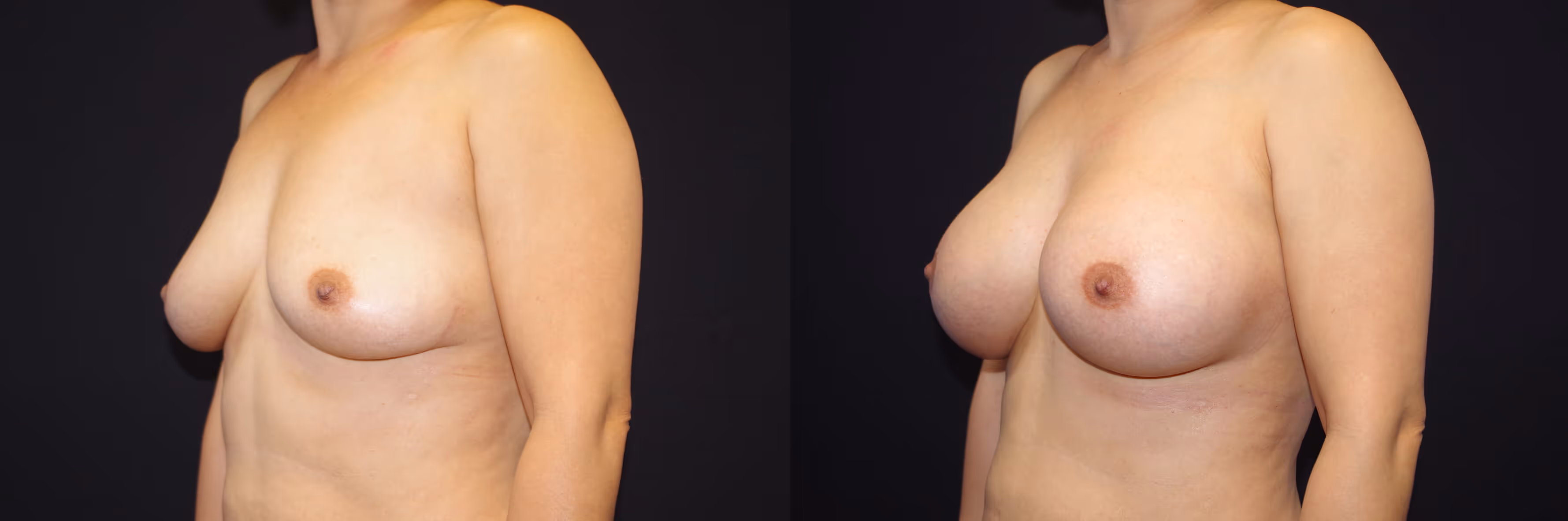 Before And After Patient Image
