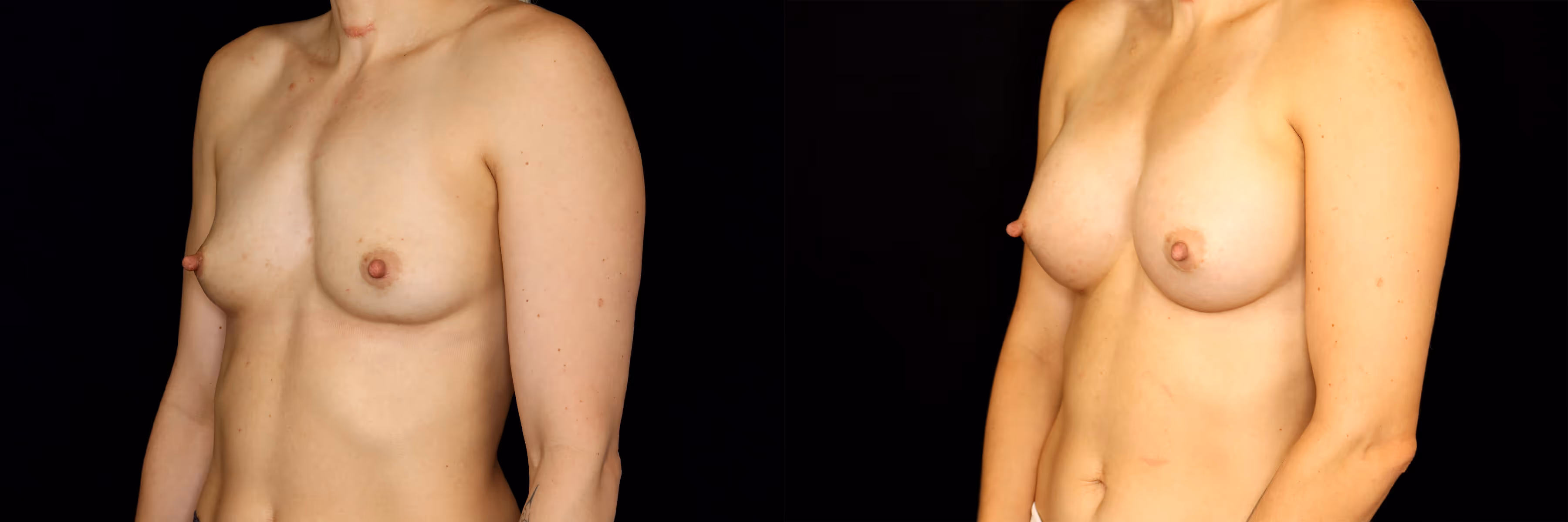 Before And After Patient Image