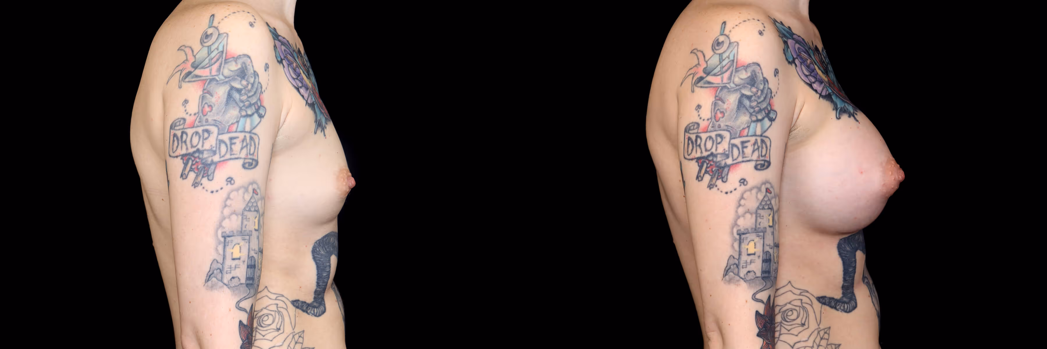 Before And After Patient Image