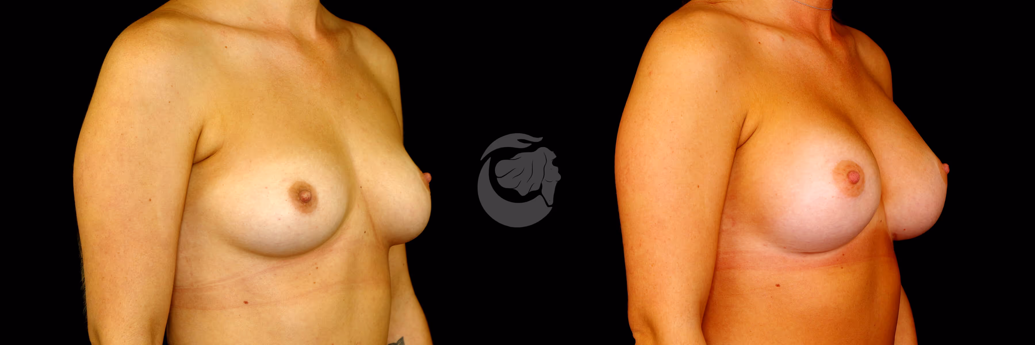 Before And After Patient Image