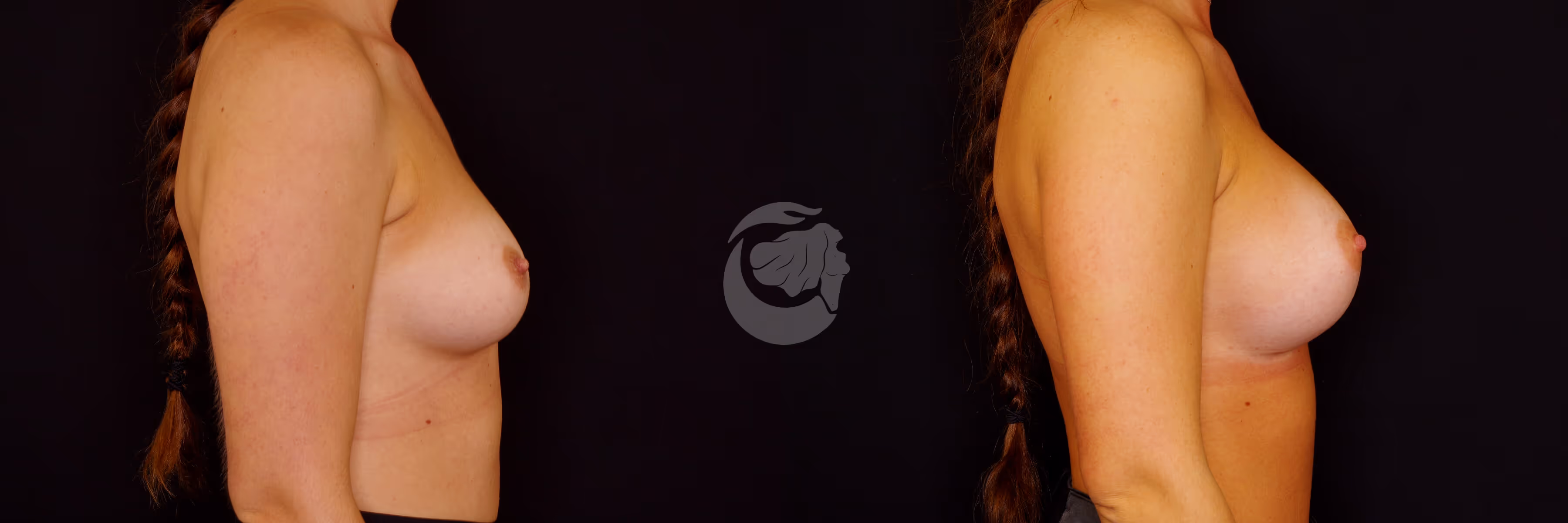 Before And After Patient Image