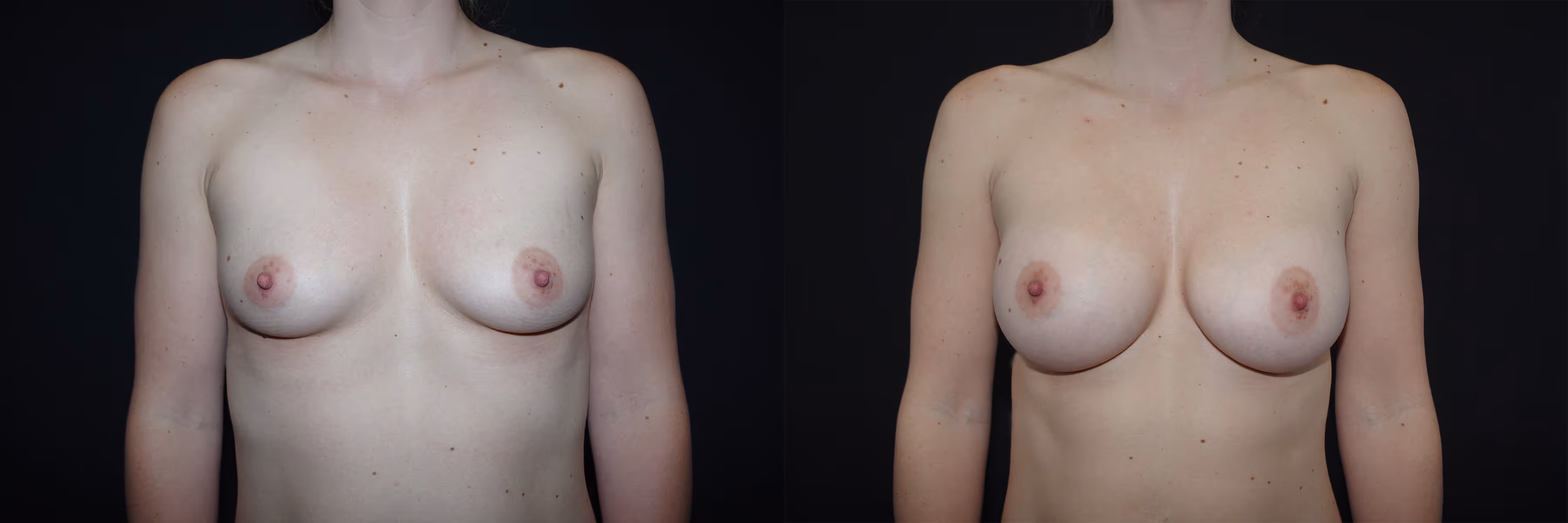 Before And After Patient Image