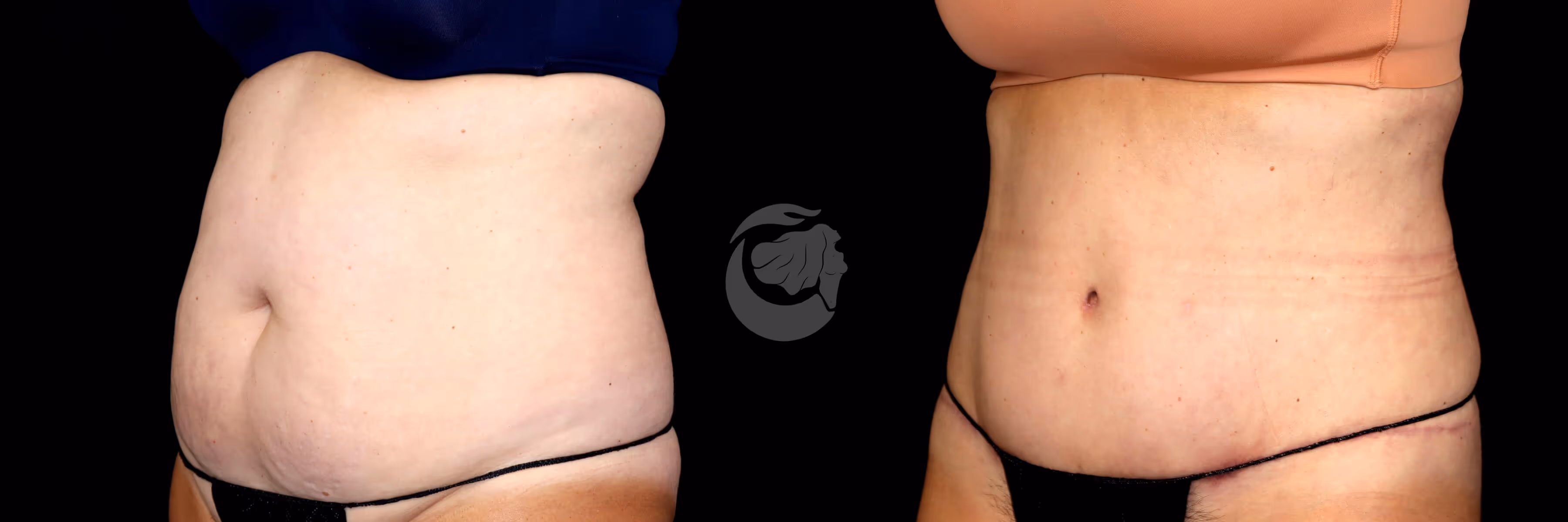 Before And After Patient Image
