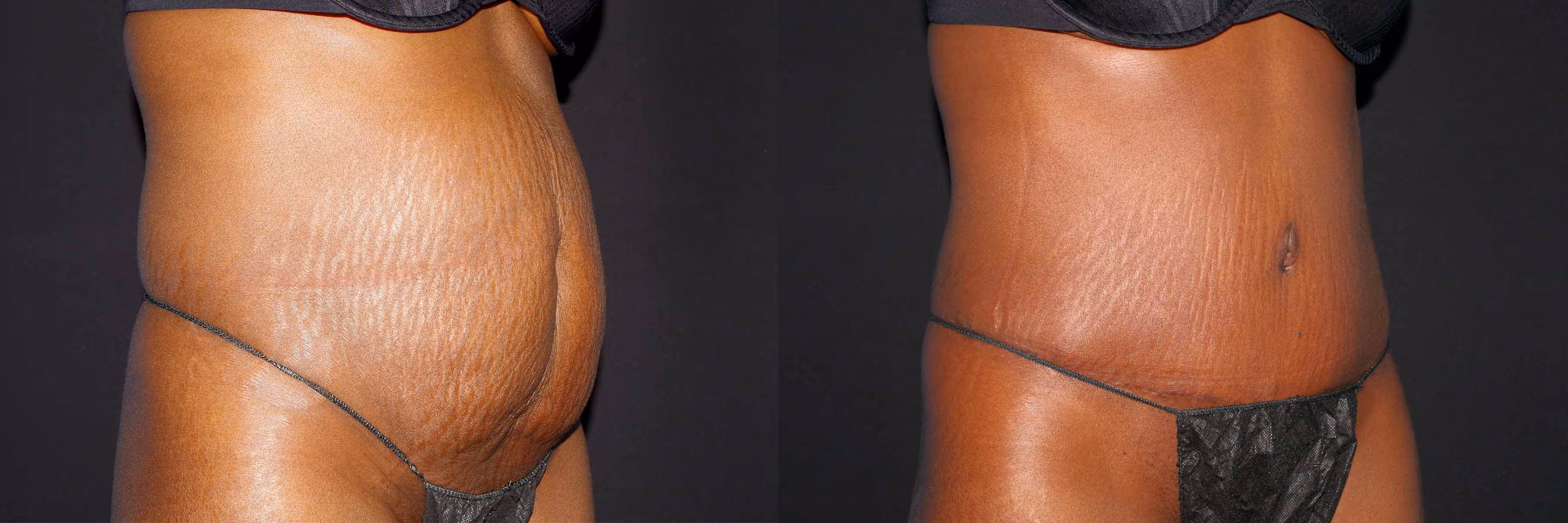 Before And After Patient Image