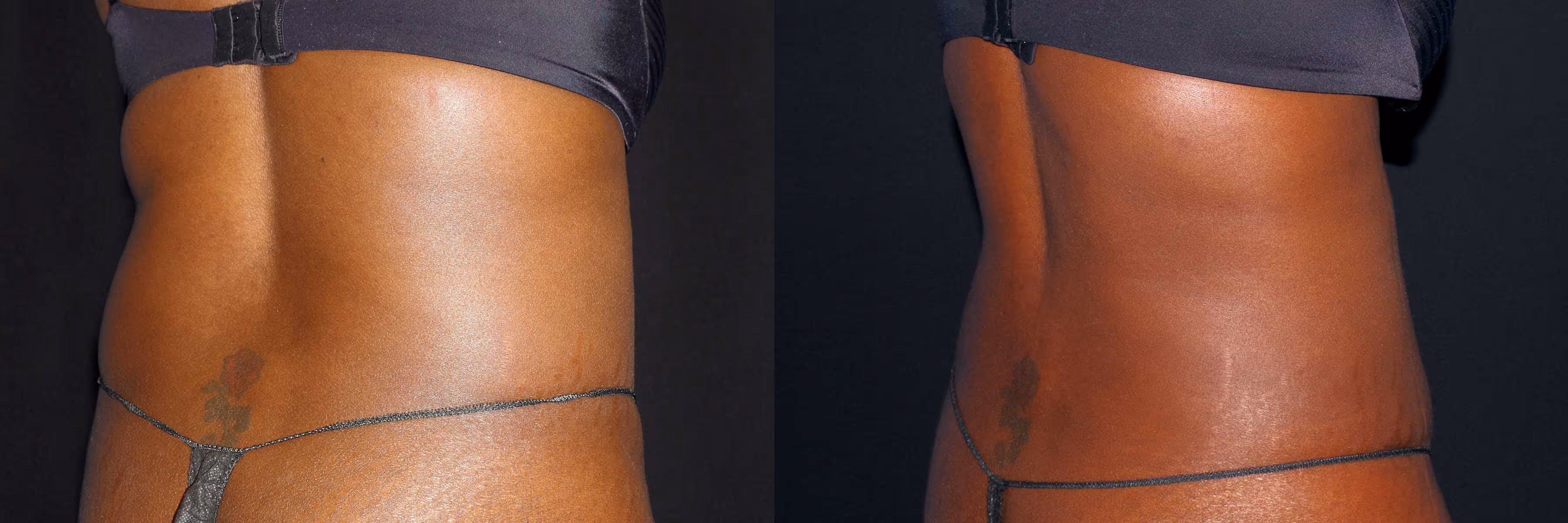 Before And After Patient Image
