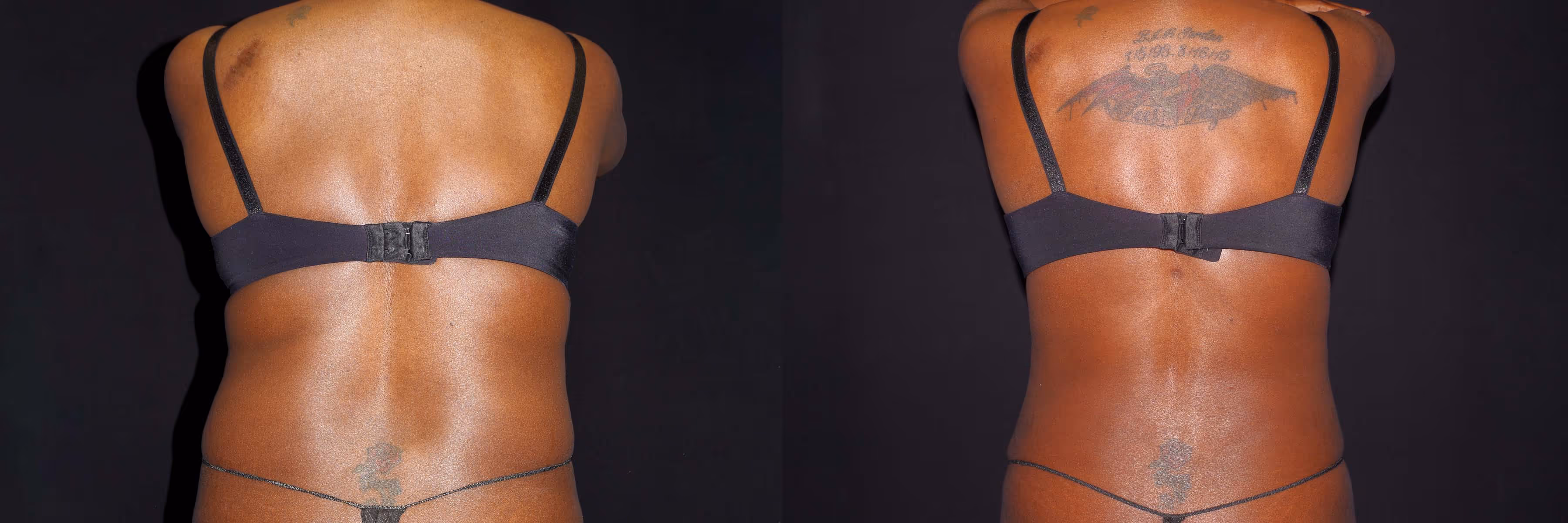 Before And After Patient Image