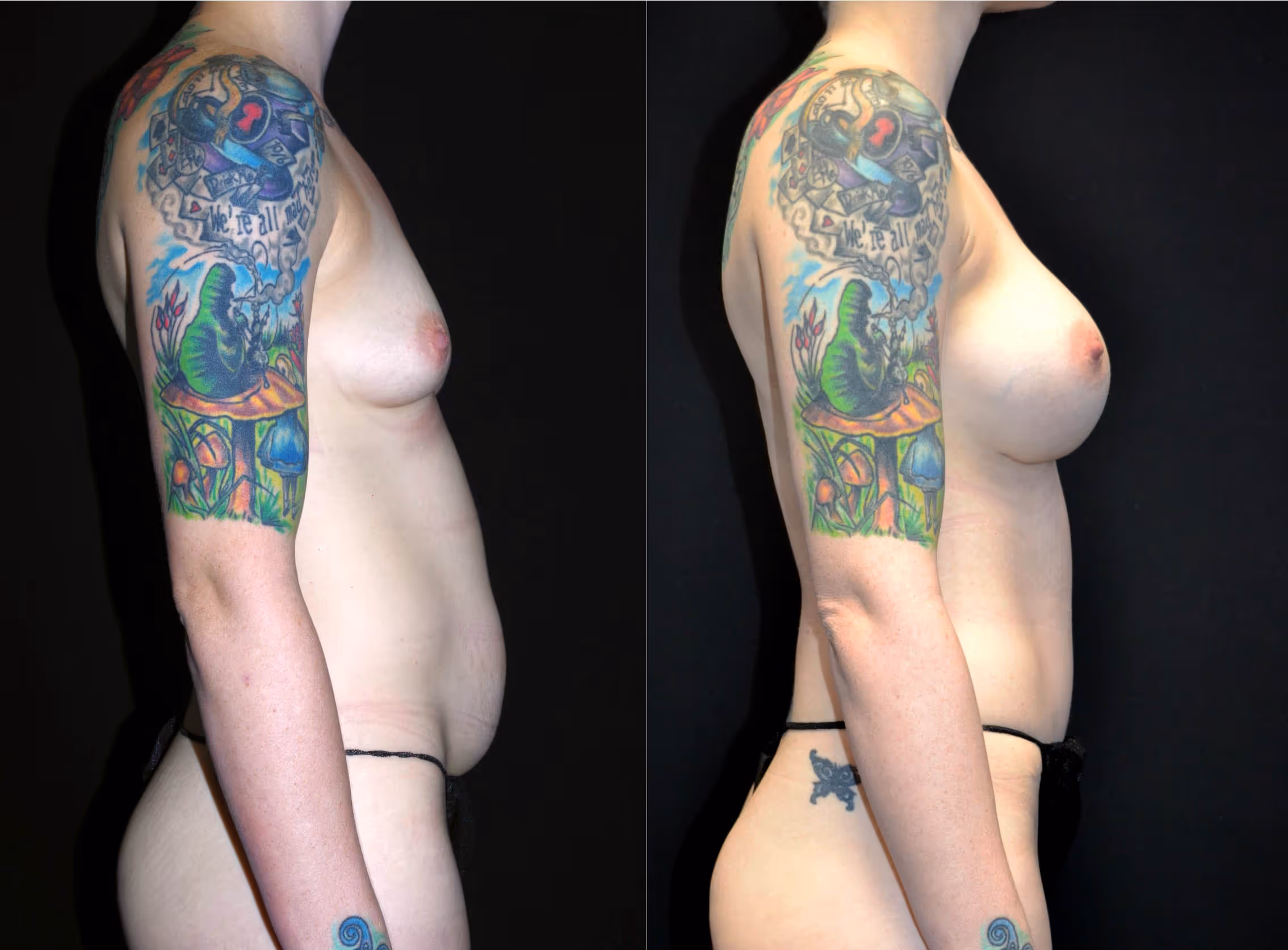 Before And After Patient Image