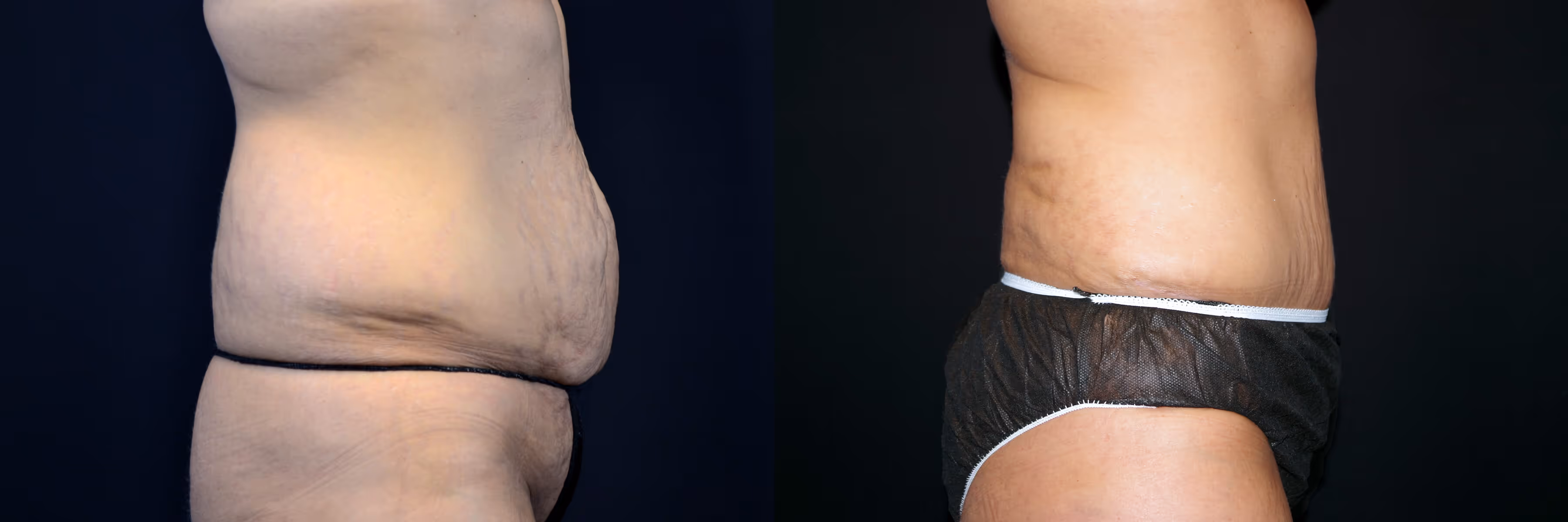 Before And After Patient Image