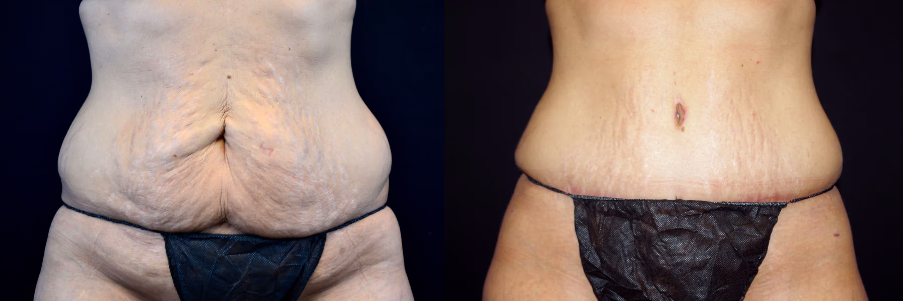 Before And After Patient Image