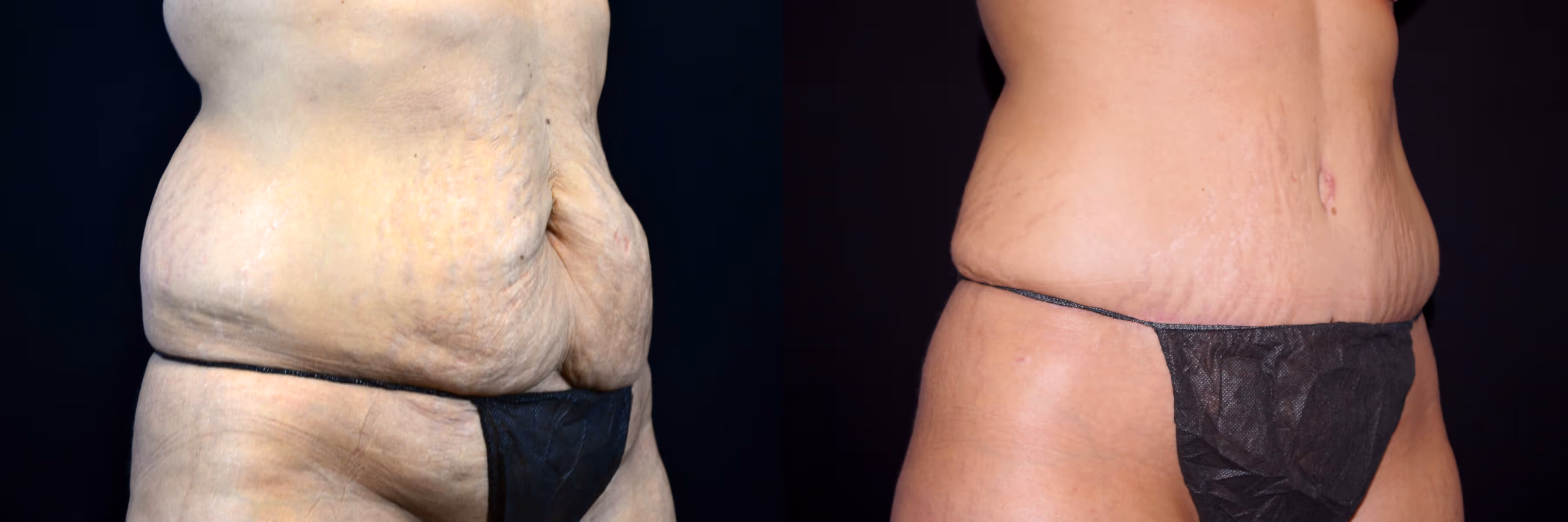 Before And After Patient Image