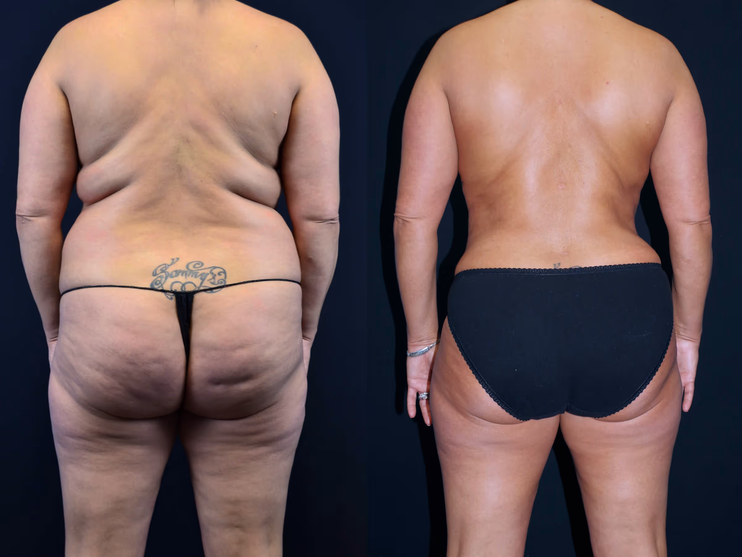 Before And After Patient Image
