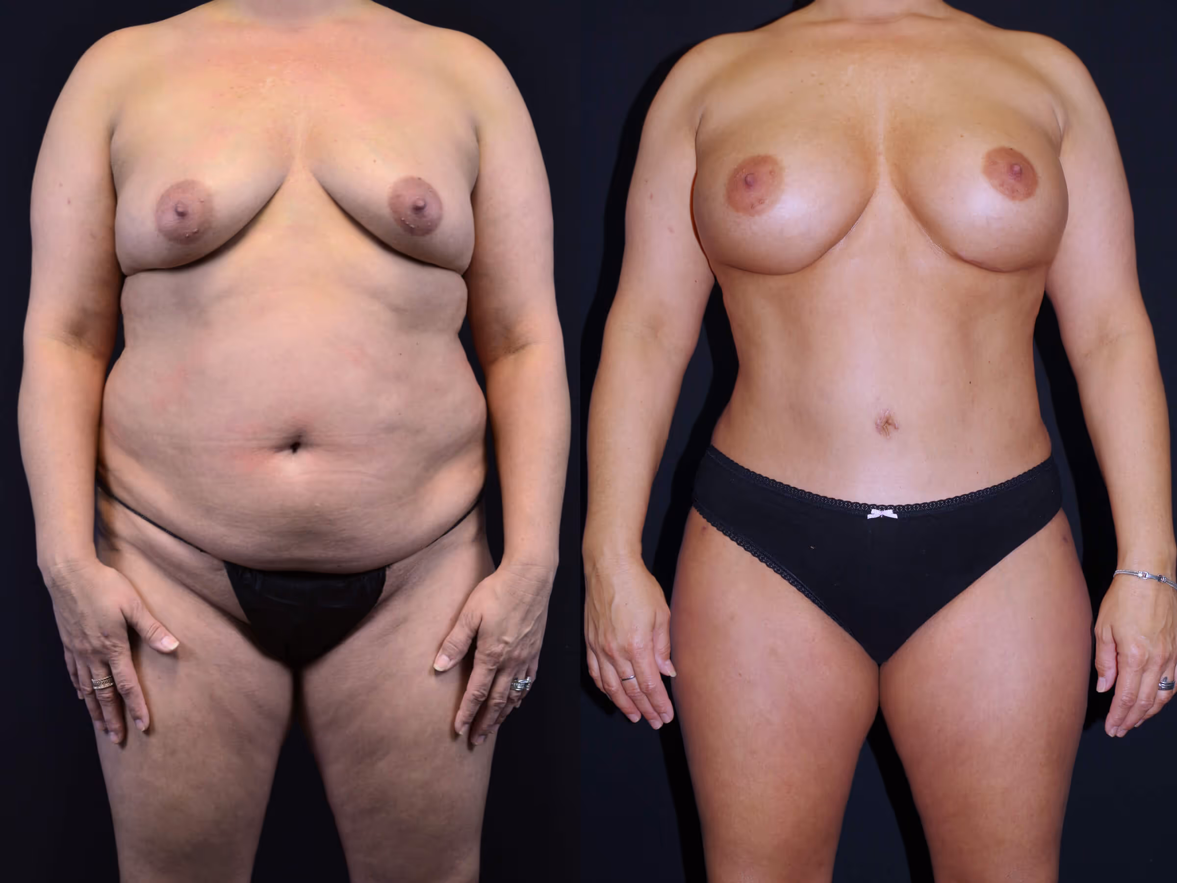 Before And After Patient Image