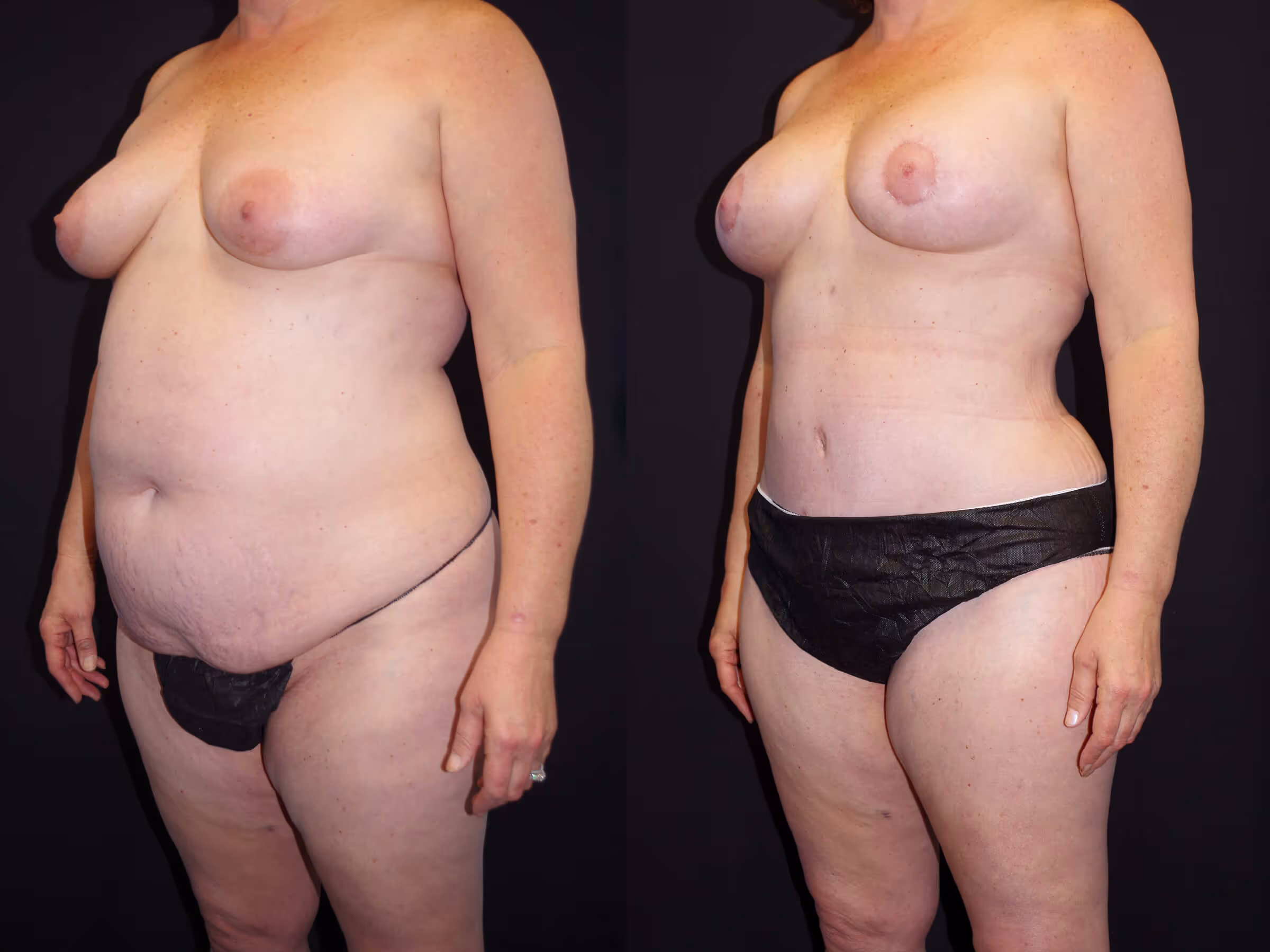 Before And After Patient Image