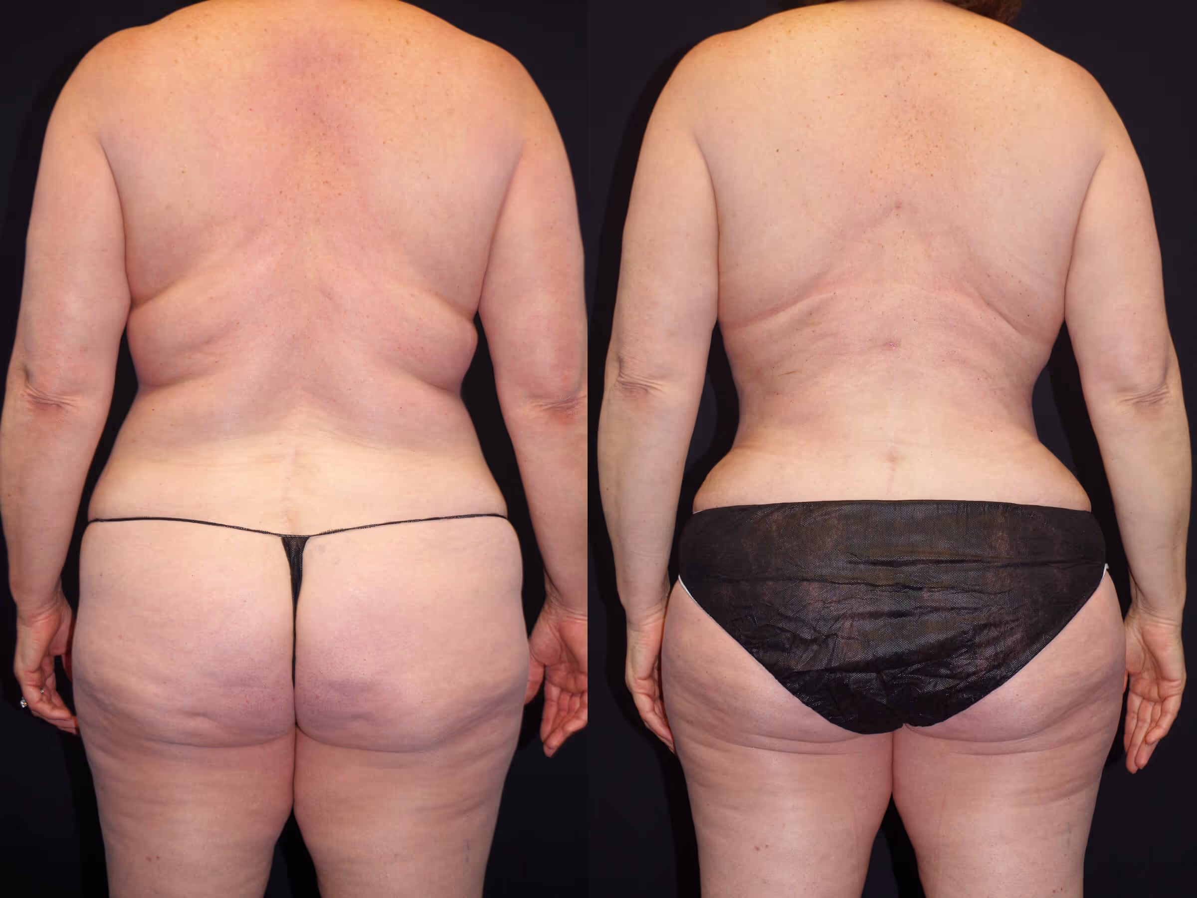 Before And After Patient Image