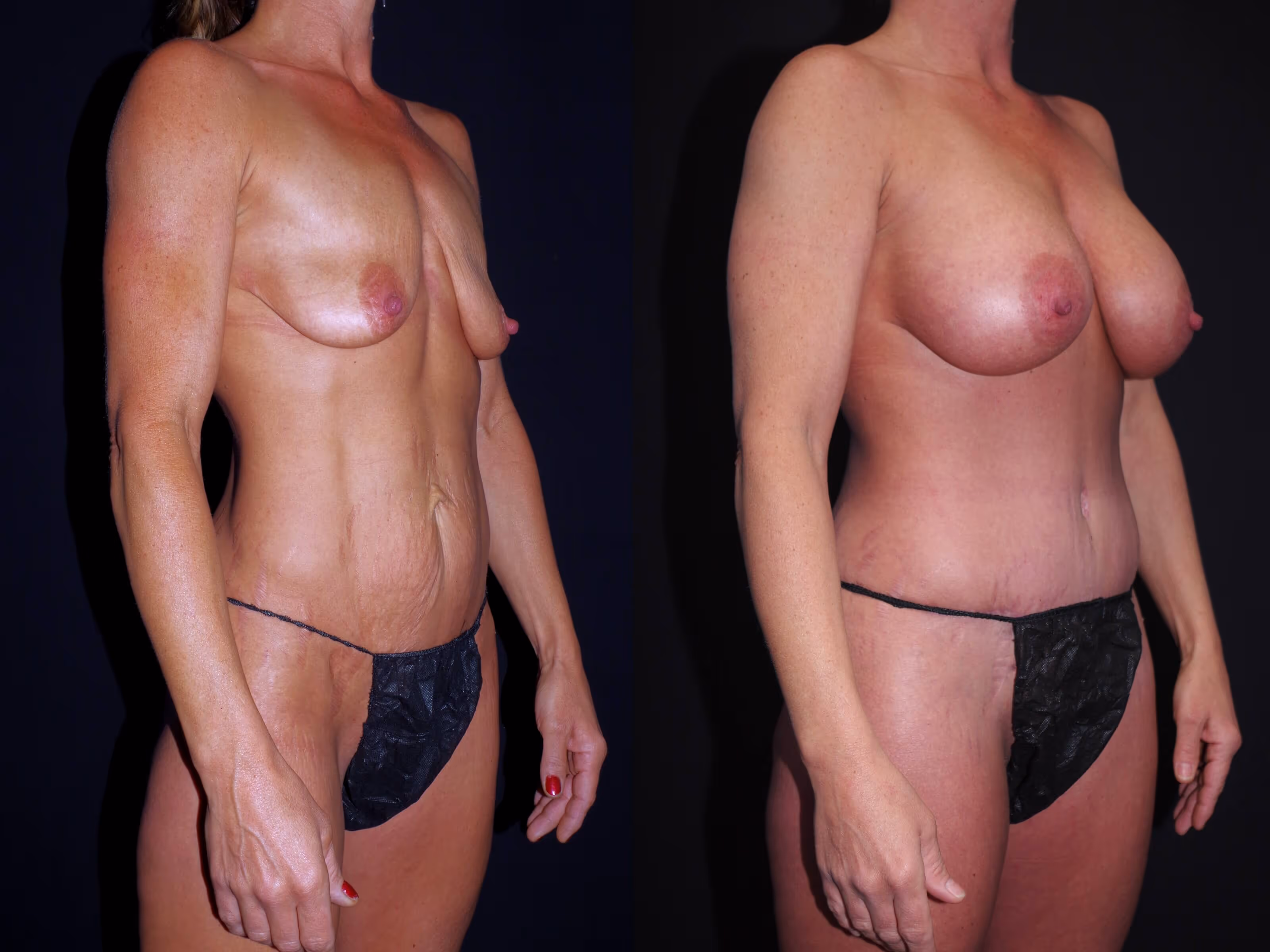 Before And After Patient Image