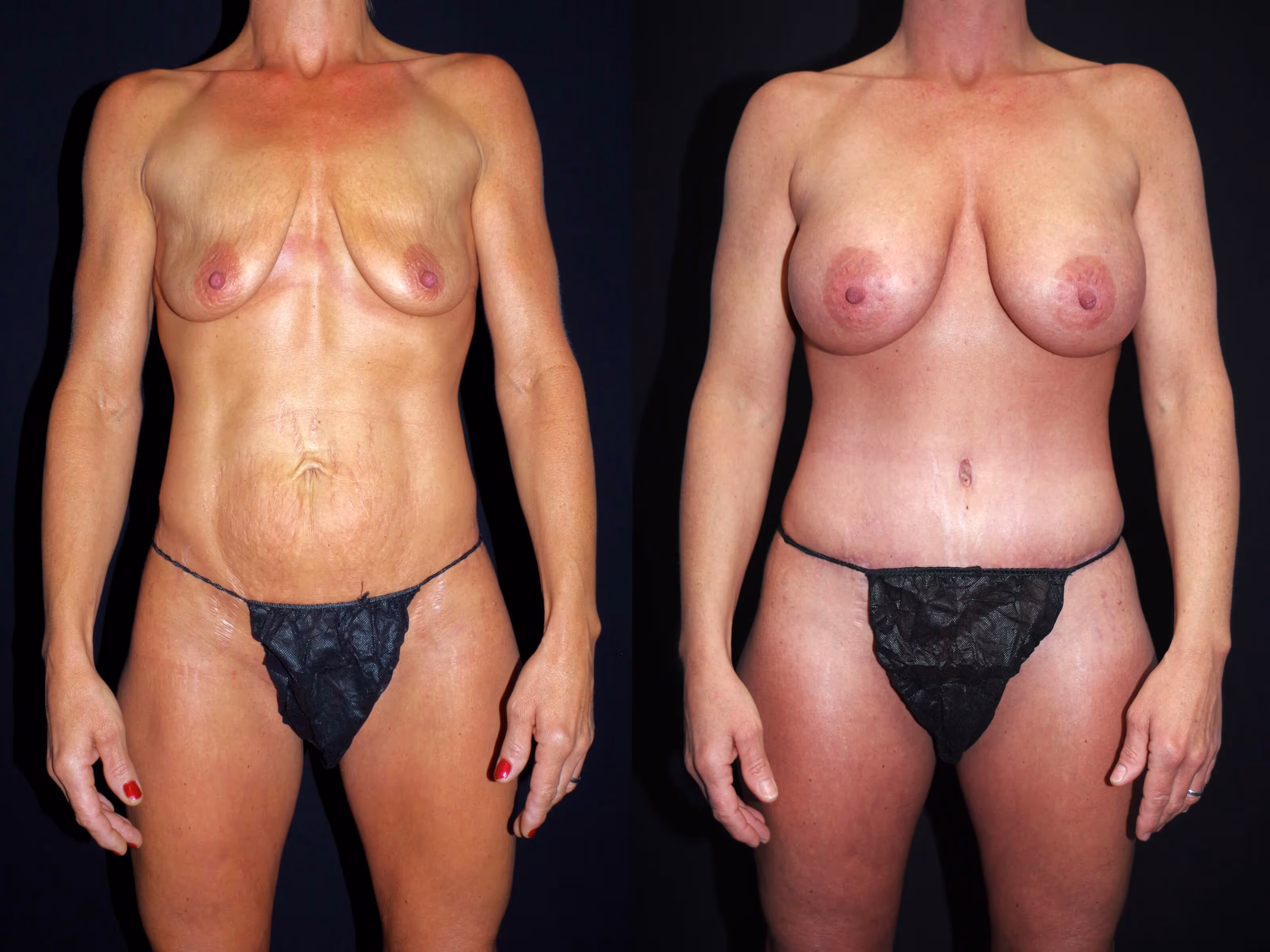 Before And After Patient Image