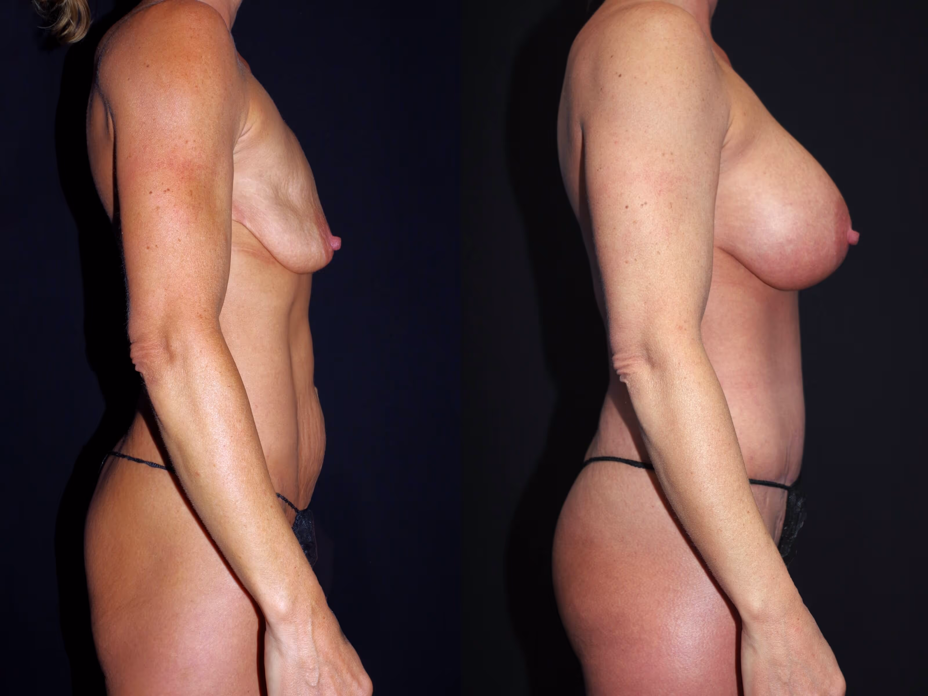 Before And After Patient Image