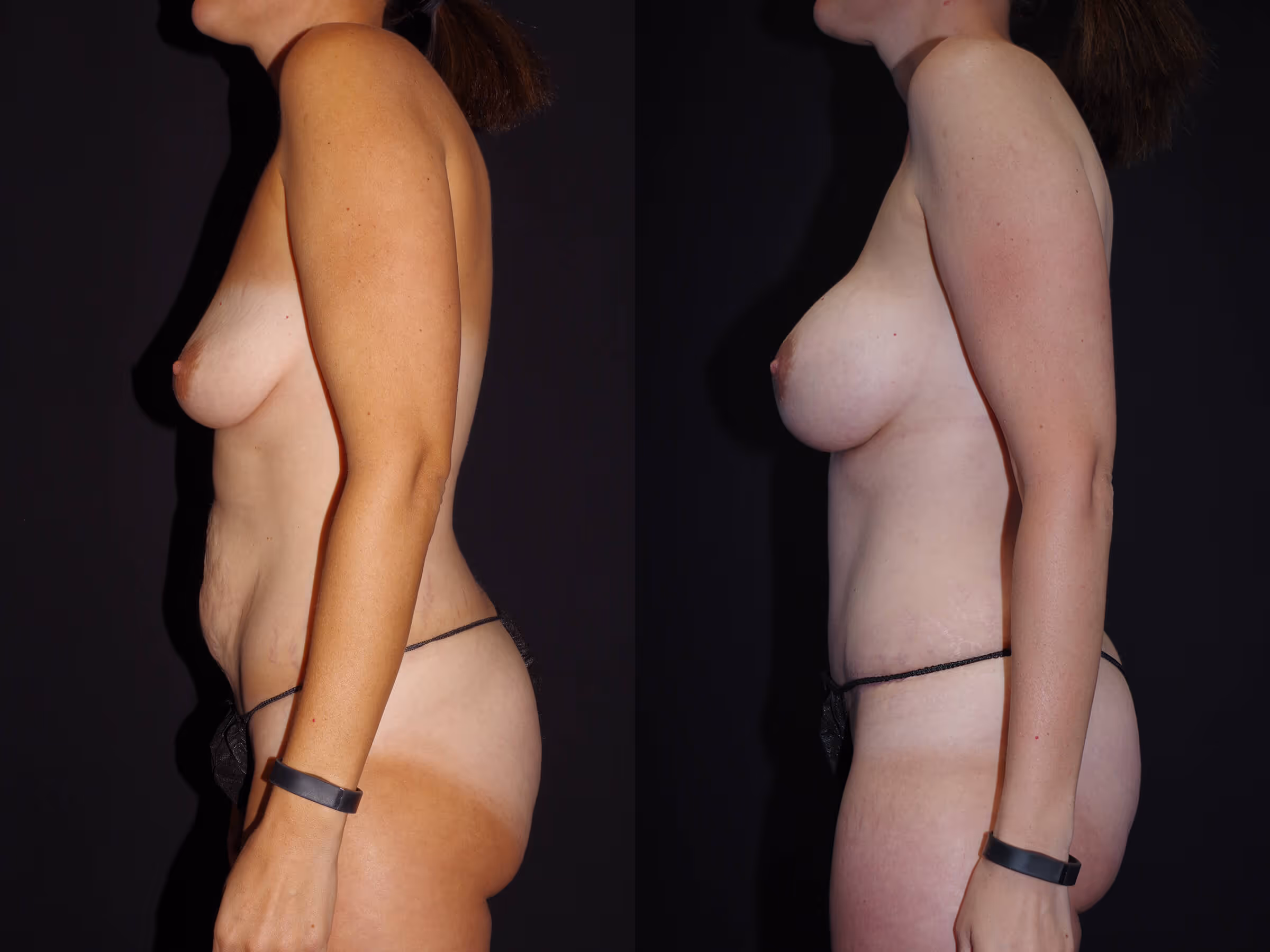Before And After Patient Image
