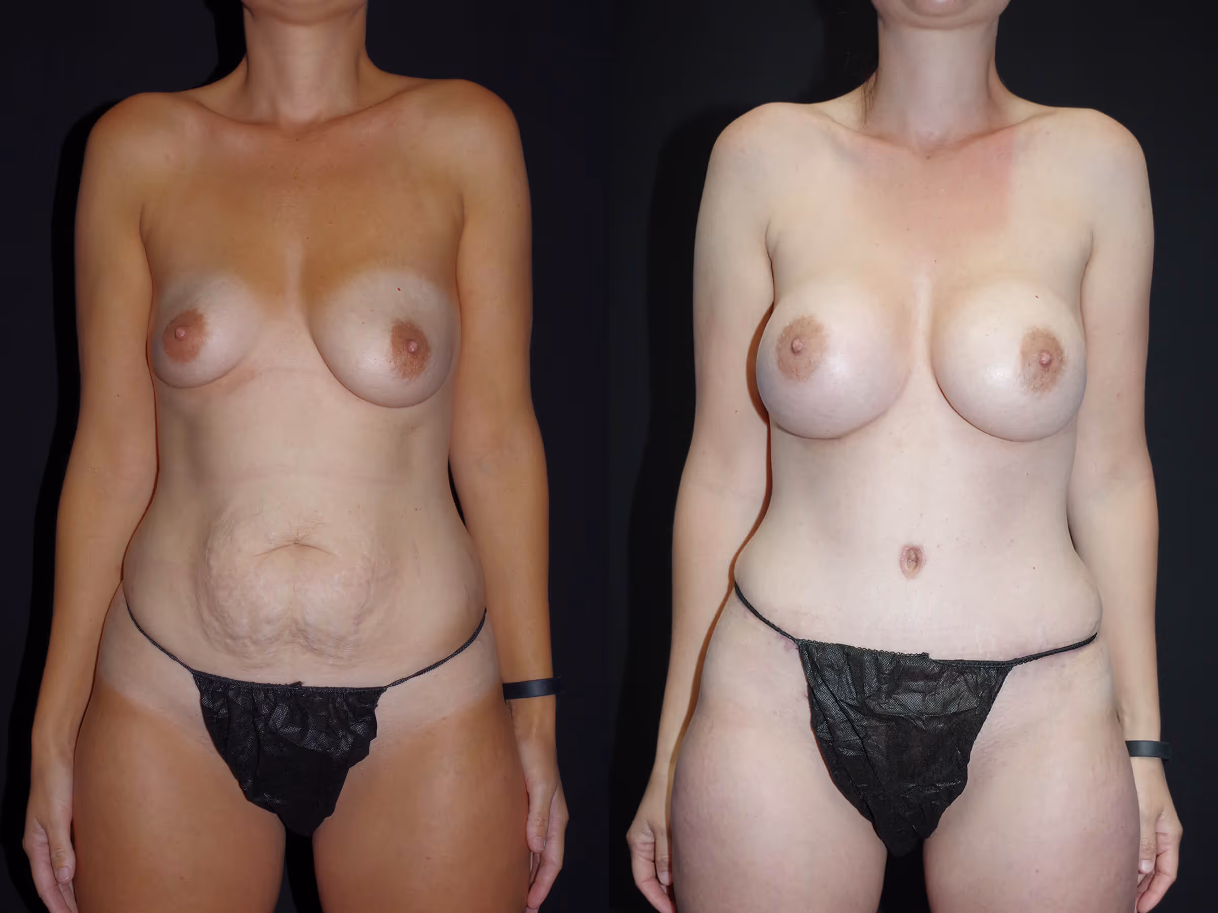 Before And After Patient Image