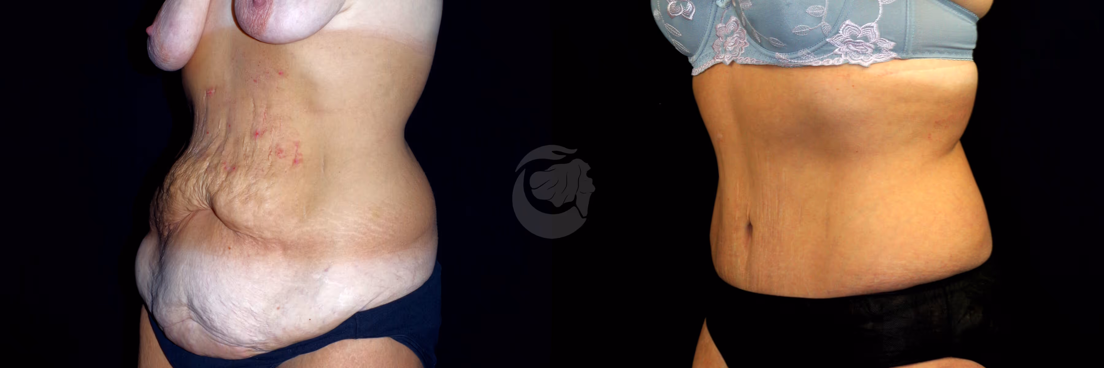 Before And After Patient Image