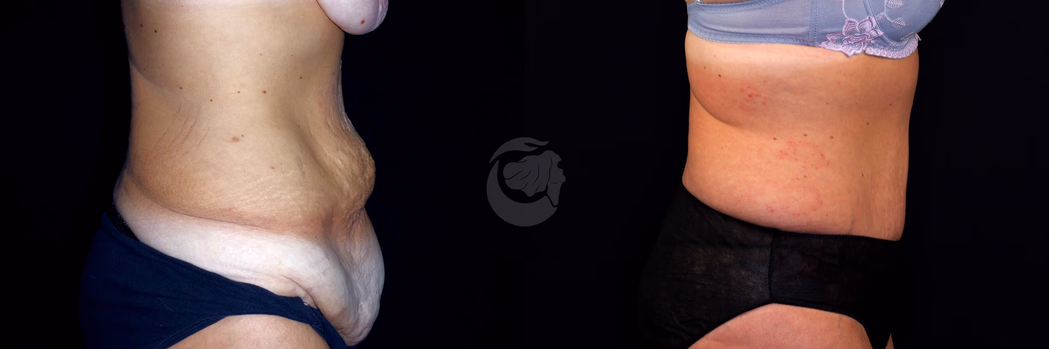 Before And After Patient Image