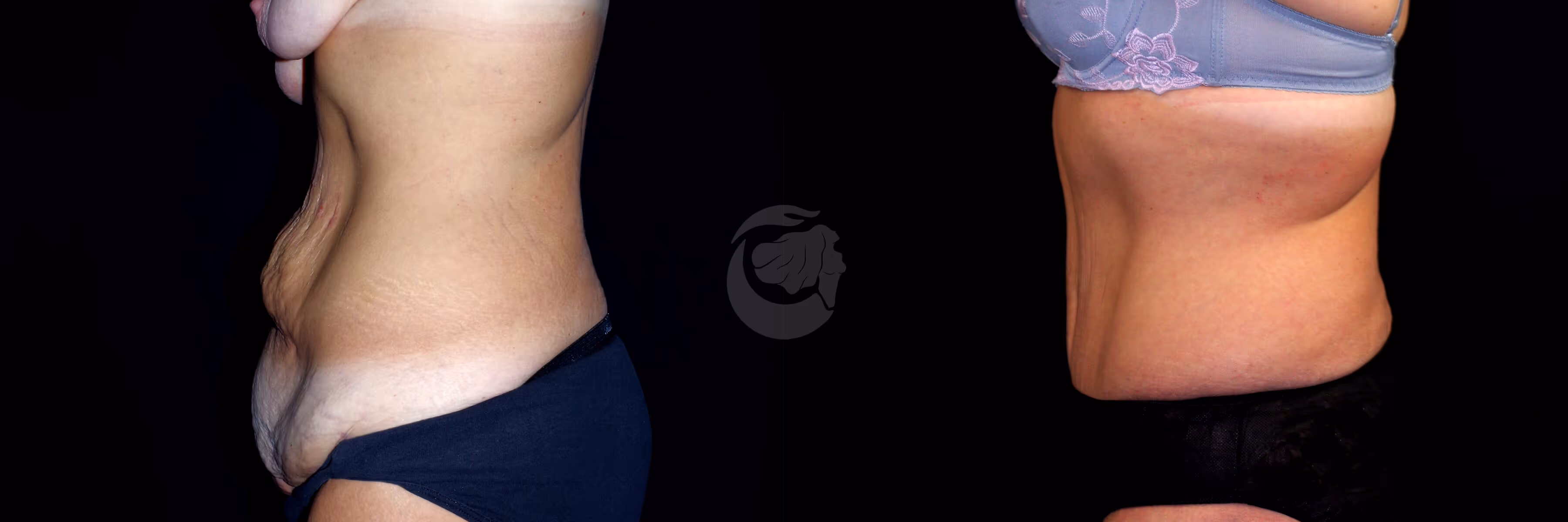 Before And After Patient Image