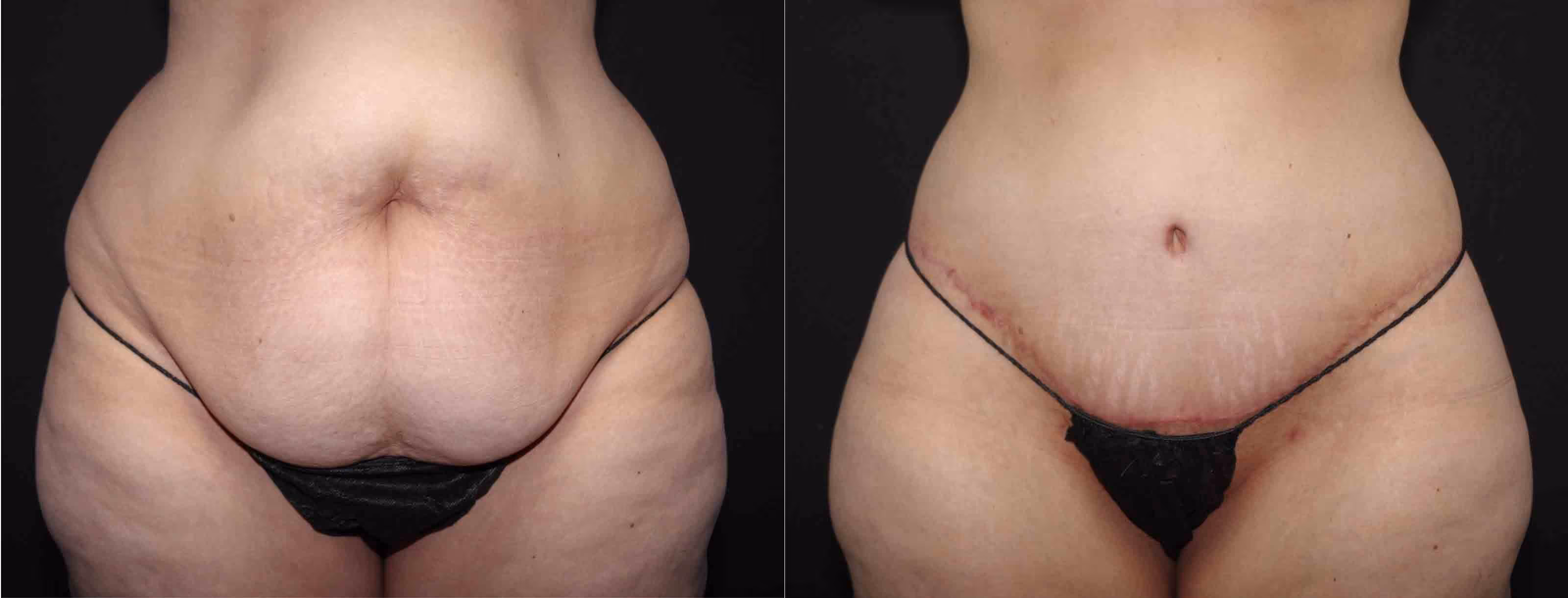 Before And After Patient Image