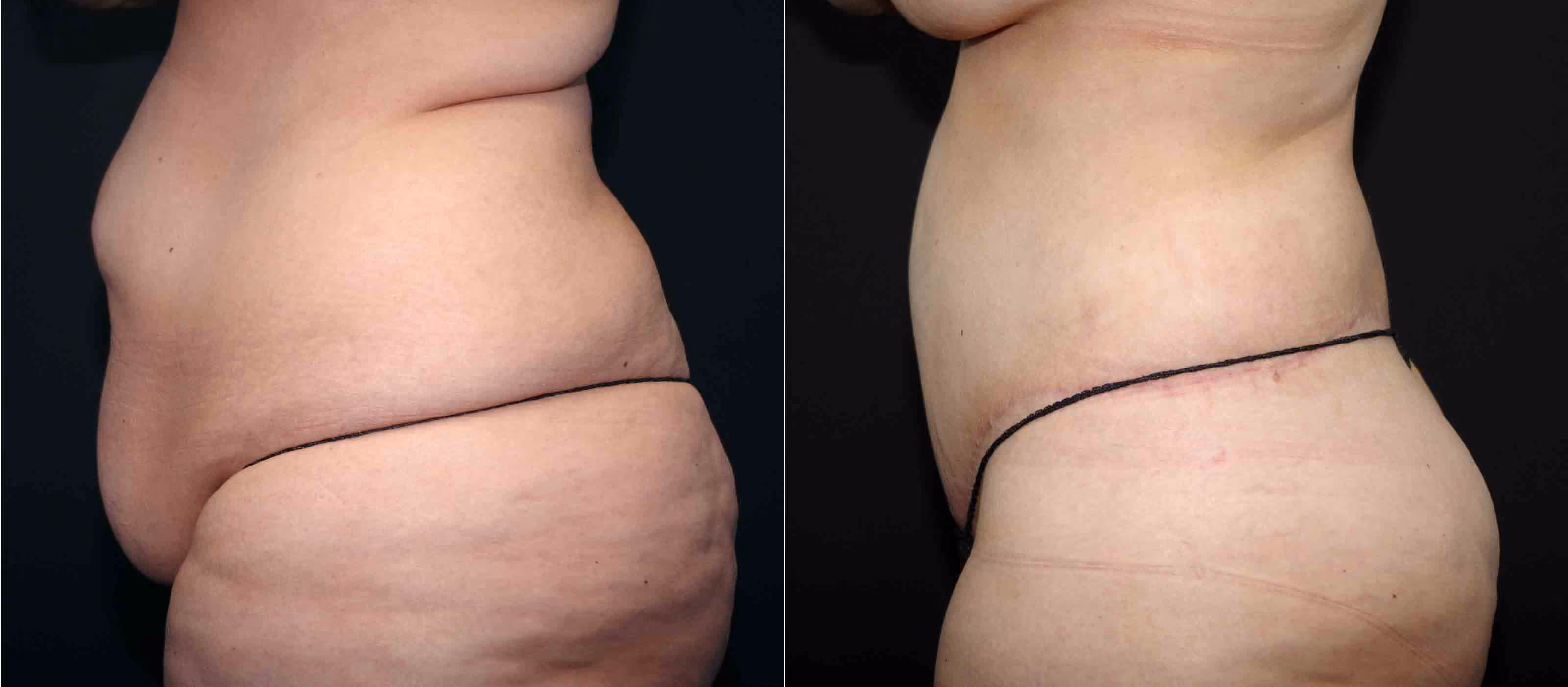 Before And After Patient Image