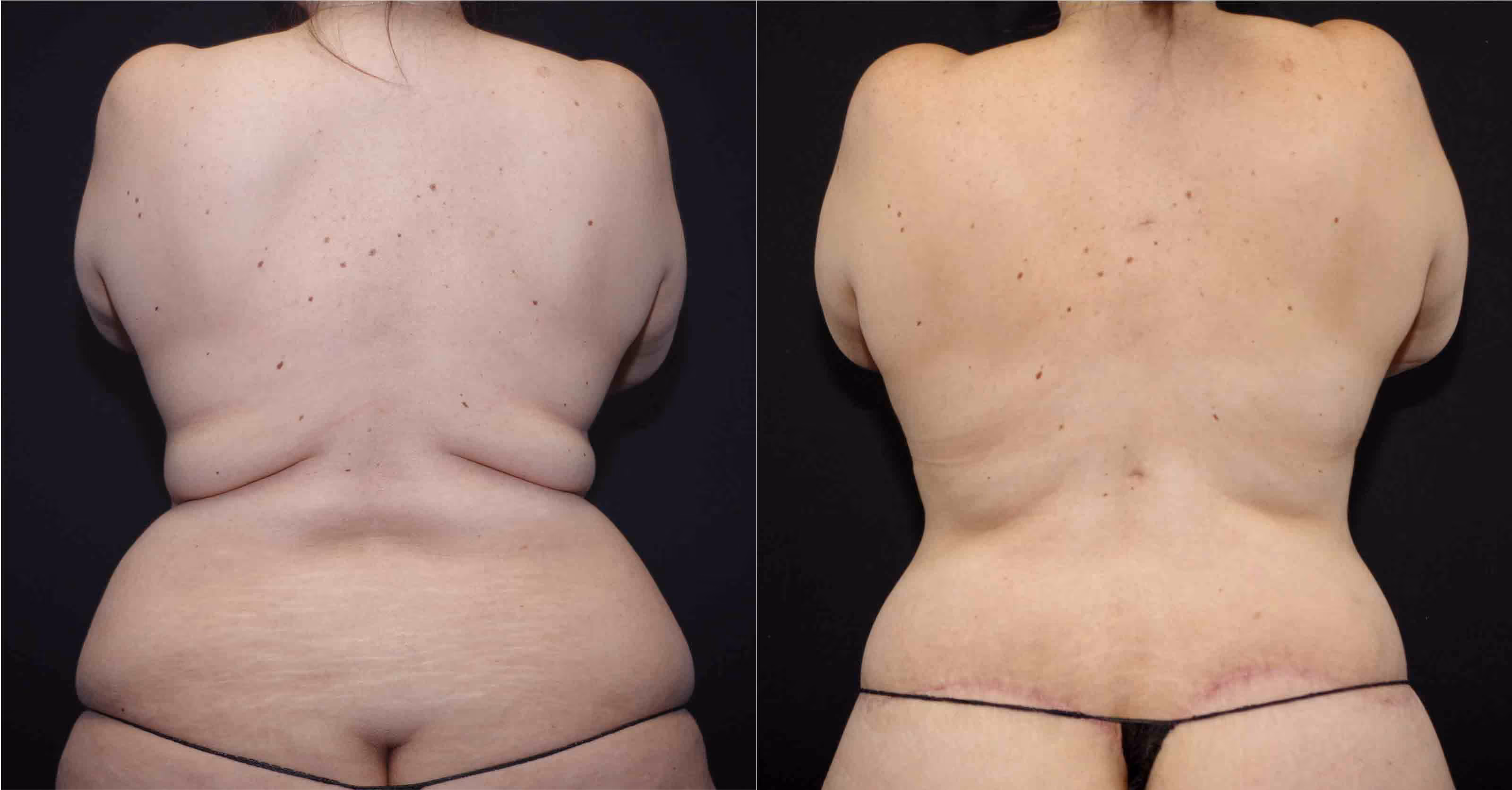Before And After Patient Image