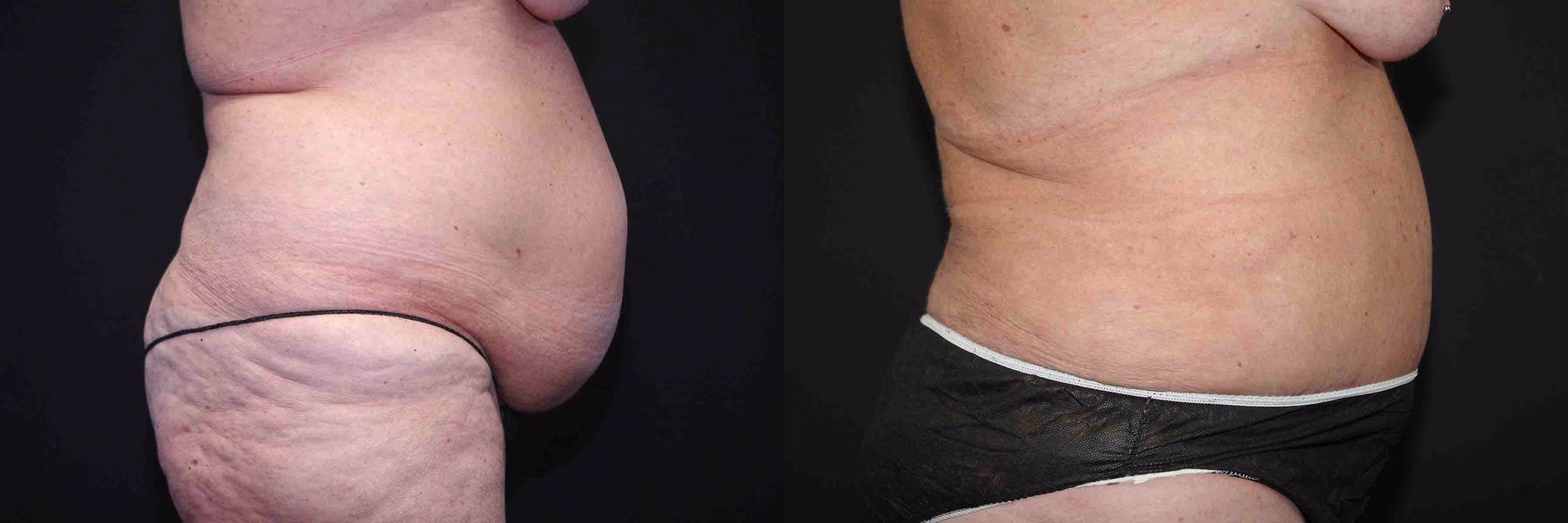 Before And After Patient Image