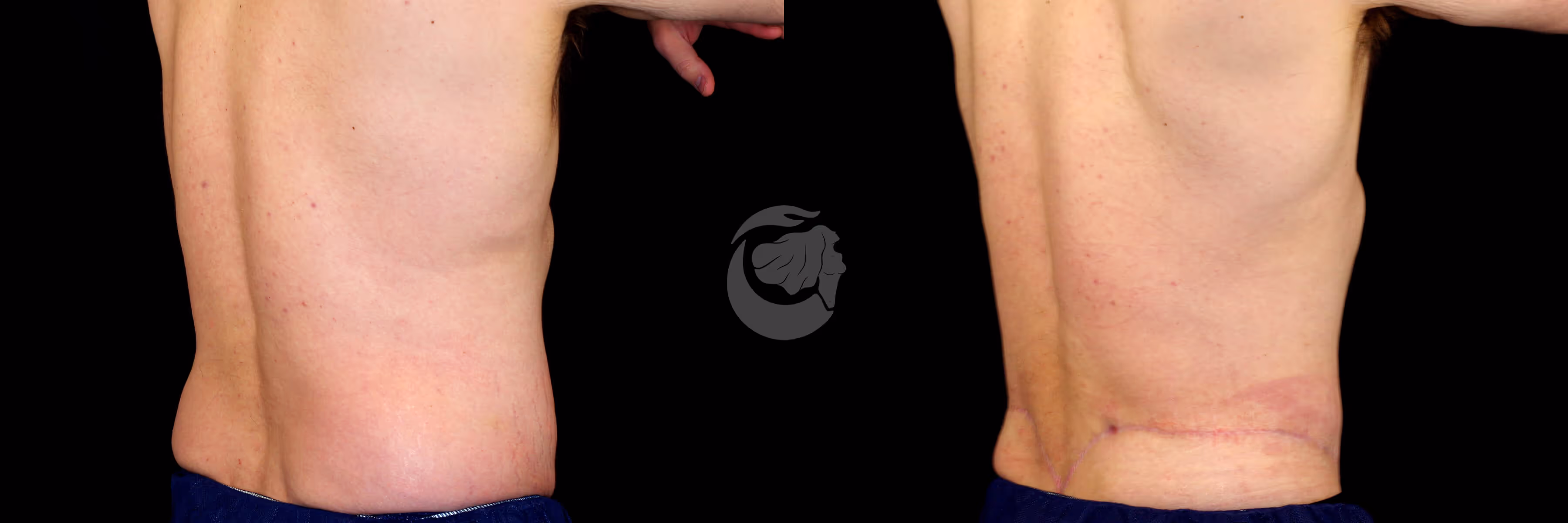 Before And After Patient Image