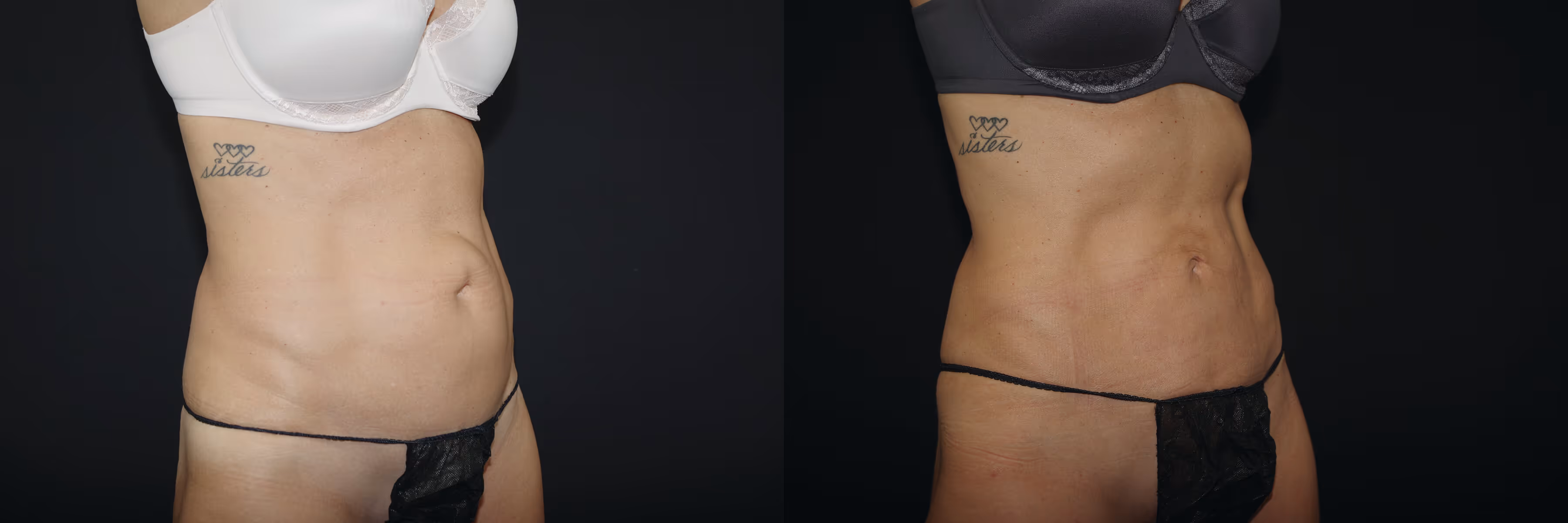 Before And After Patient Image