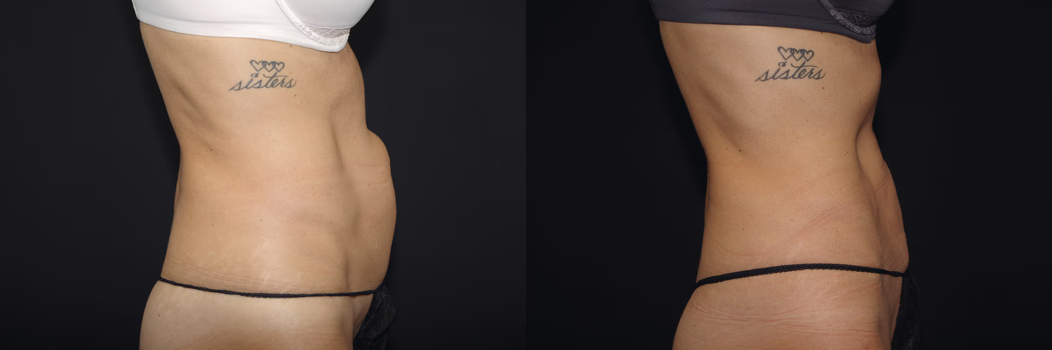 Before And After Patient Image