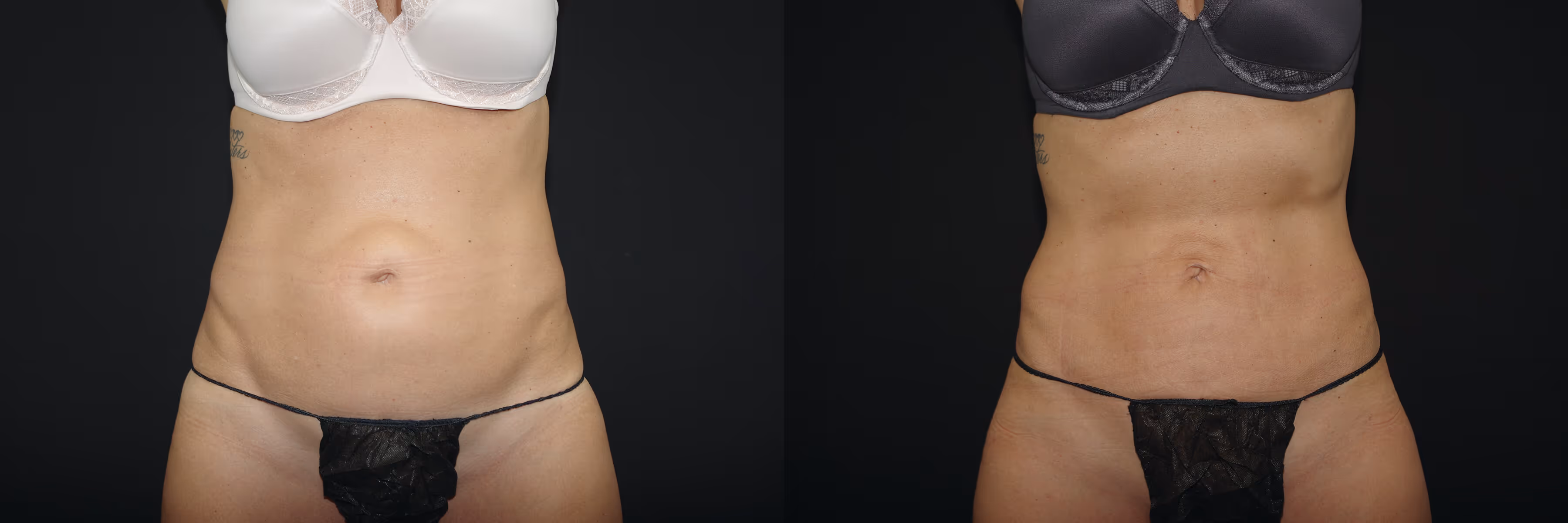 Before And After Patient Image