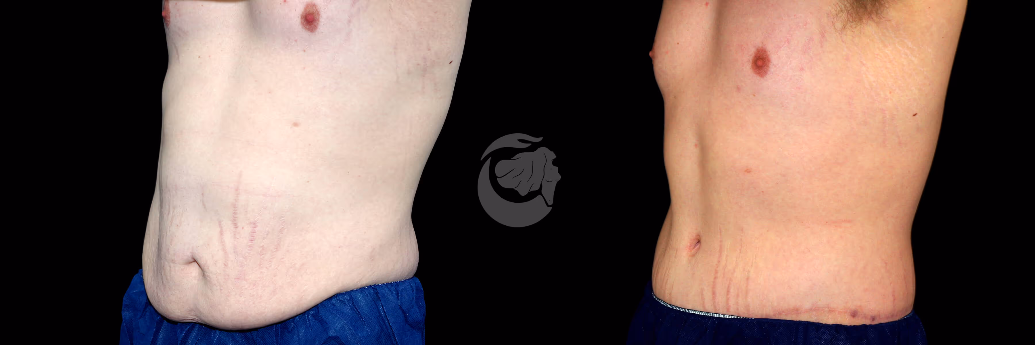 Before And After Patient Image