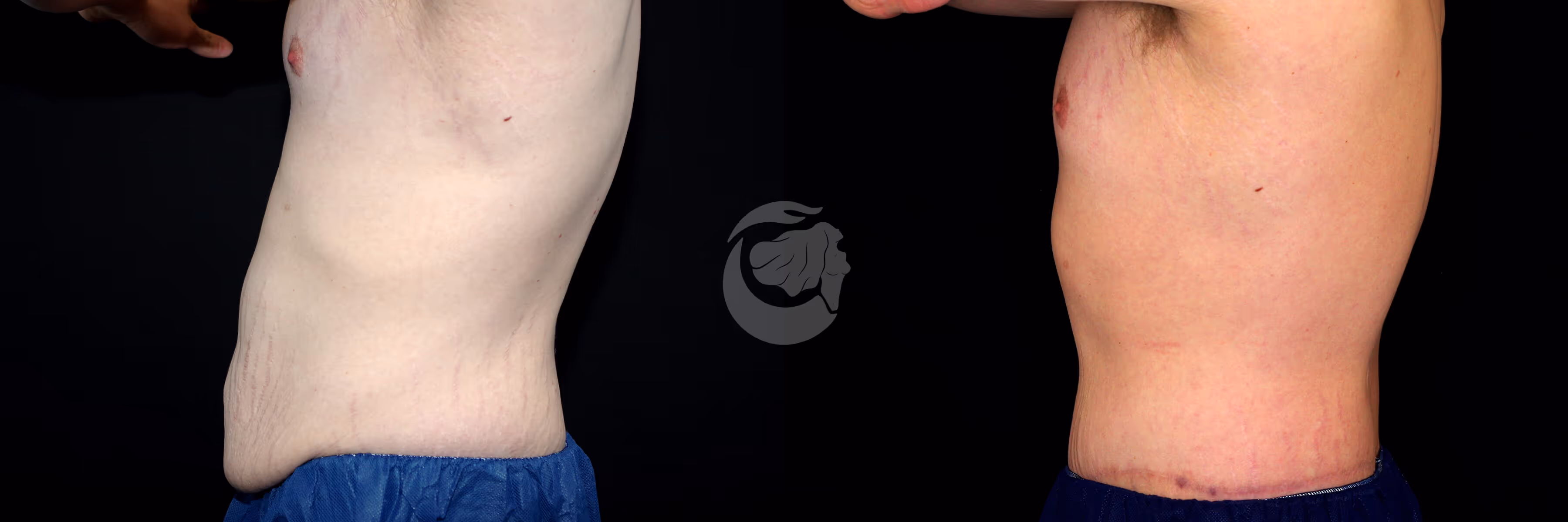 Before And After Patient Image